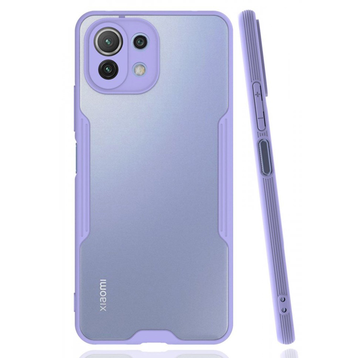 Nettech Xiaomi Mi 11 Lite Uyumlu Platin Seri Arka Koruma Kılıf NT-86524