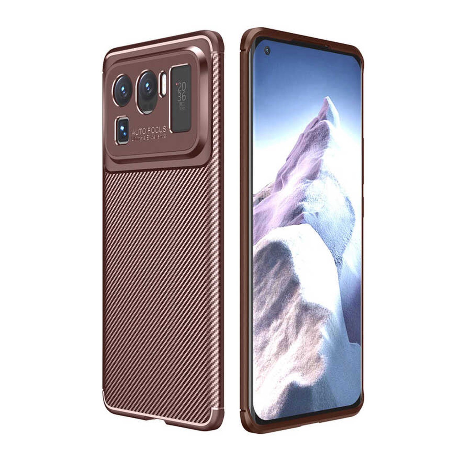 Nettech Xiaomi Mi 11 Pro Uyumlu Auto Seri Arka Koruma Kılıf NT-88386