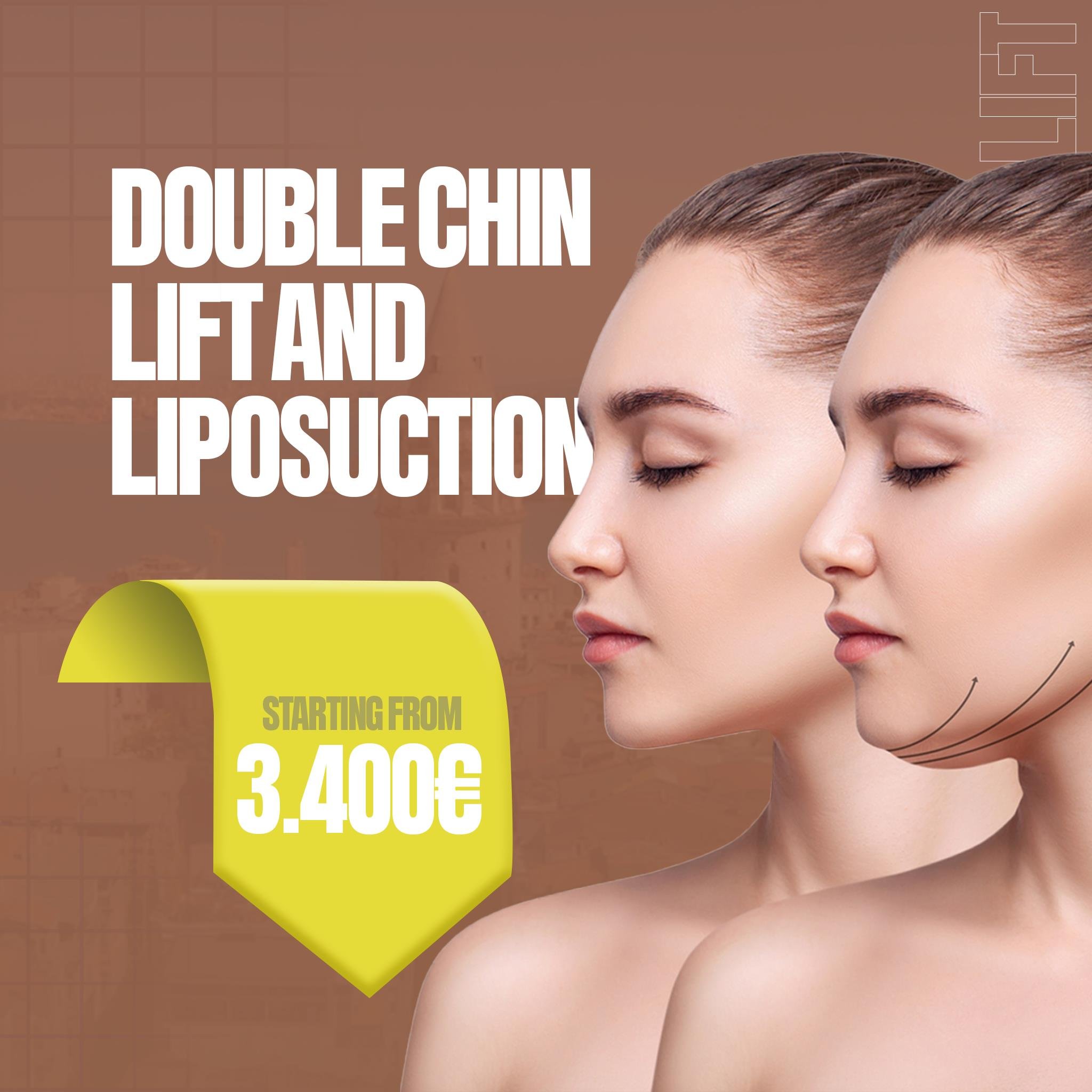 Double Chin Lift & Liposuction