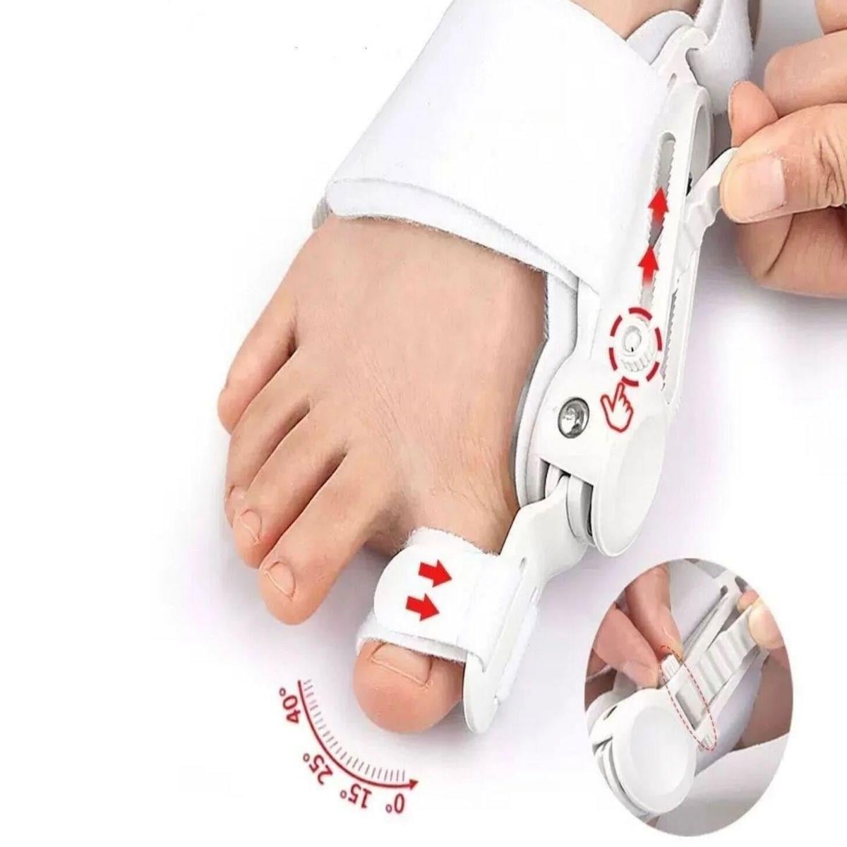 Çarşı Point® Ayarlanabilir Ayak Baş Parmak Kemik Düzeltici – Halluks Valgus (Bunyon) Aparatı, Gece Gündüz Kullanıma Uygun Ayak Düzeltme Ateli