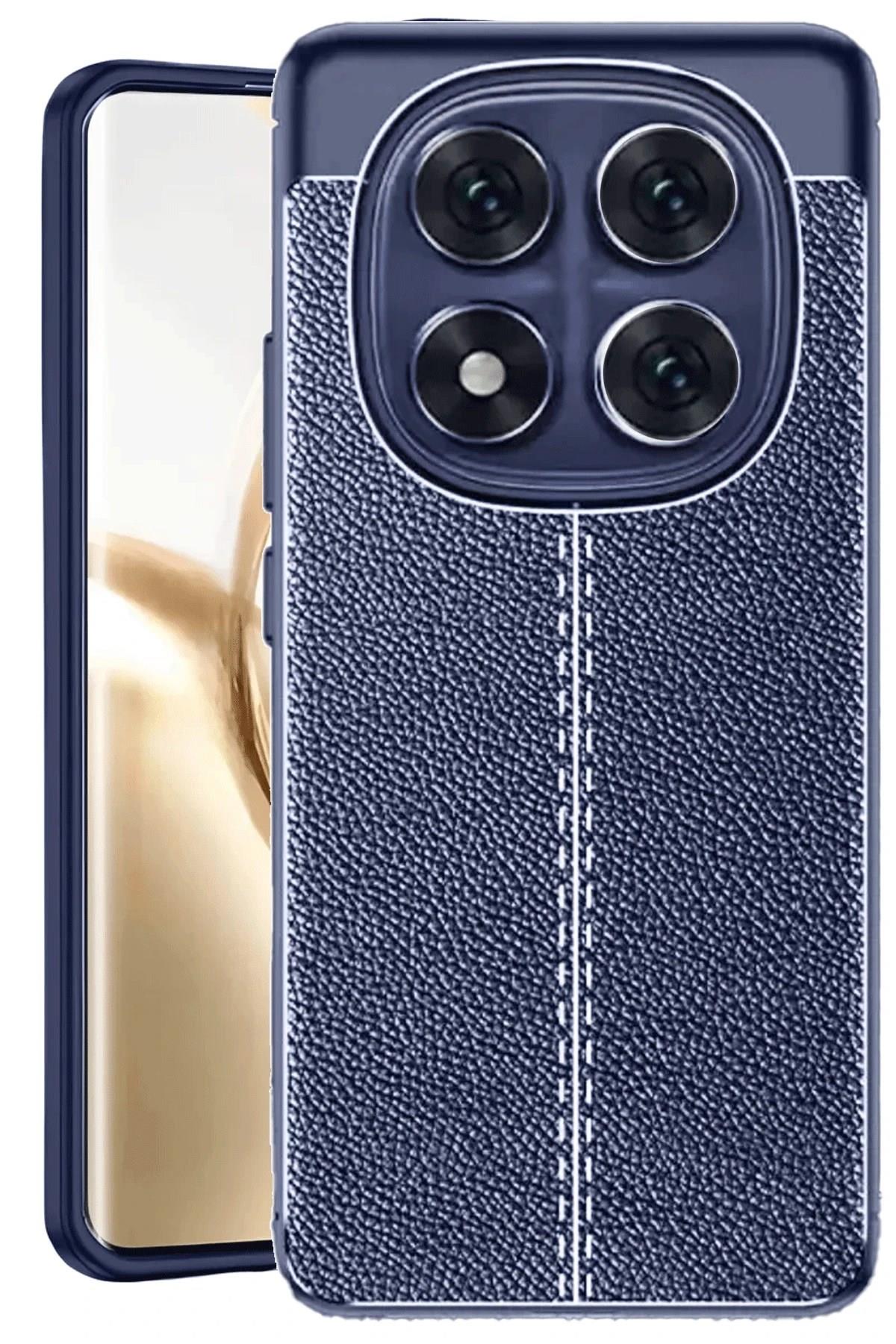Mey İthalat®   Redmi Note 14 Pro 4G Kılıf Auto Focus Kapak - Lacivert