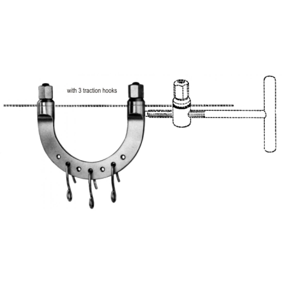 26.0420.02 Kirschner Uzatma Yayı 105x105mm