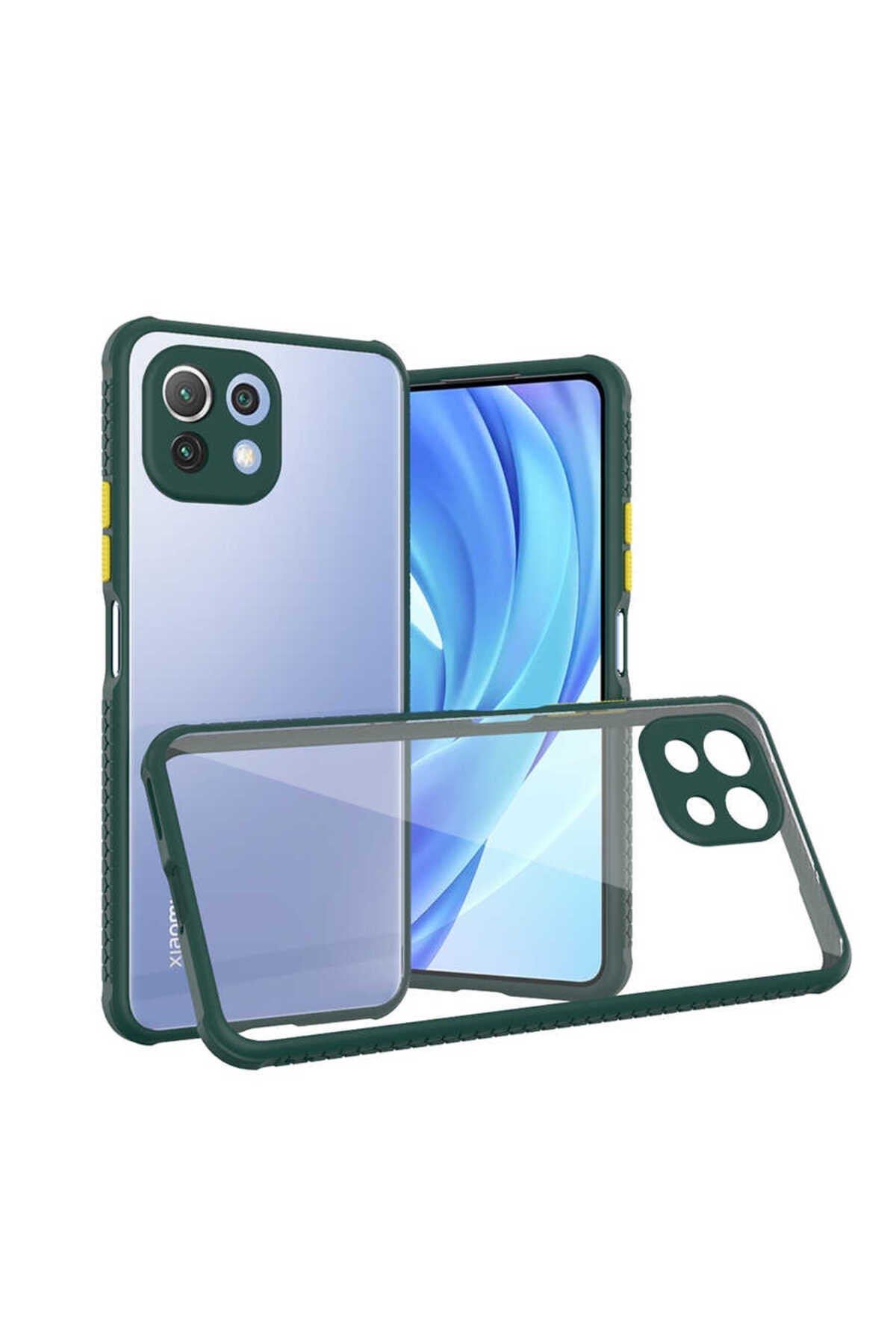 Mi 11 Lite Kılıf NVTH Kaff Kapak - Koyu Yeşil