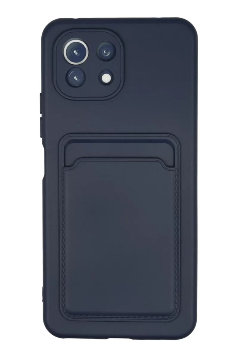 Xiaomi Mi 11 Kılıf Kelvin Kartvizitli Silikon - Lacivert