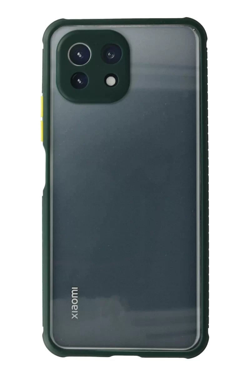Xiaomi Mİ 11 Lite Kılıf Miami Şeffaf Silikon - Koyu Yeşil