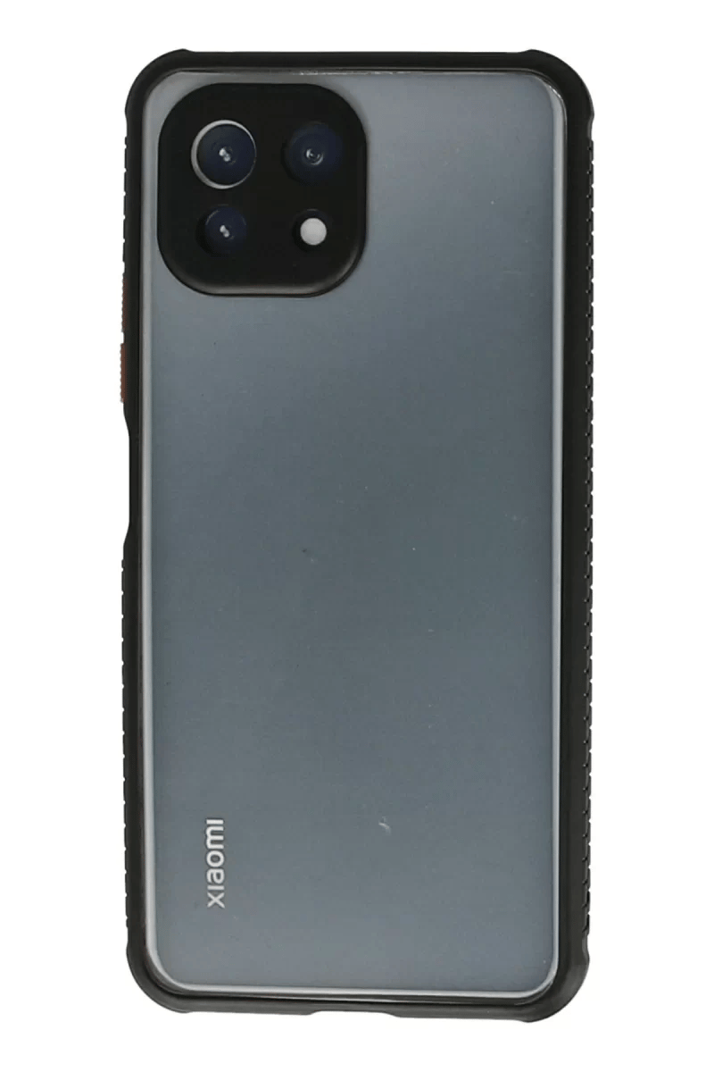 Xiaomi Mİ 11 Lite Kılıf Miami Şeffaf Silikon - Siyah