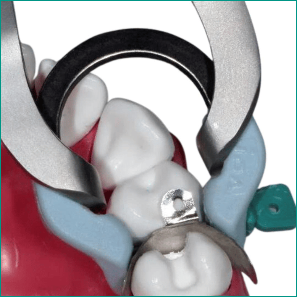 İda Dental Vigor Forseps