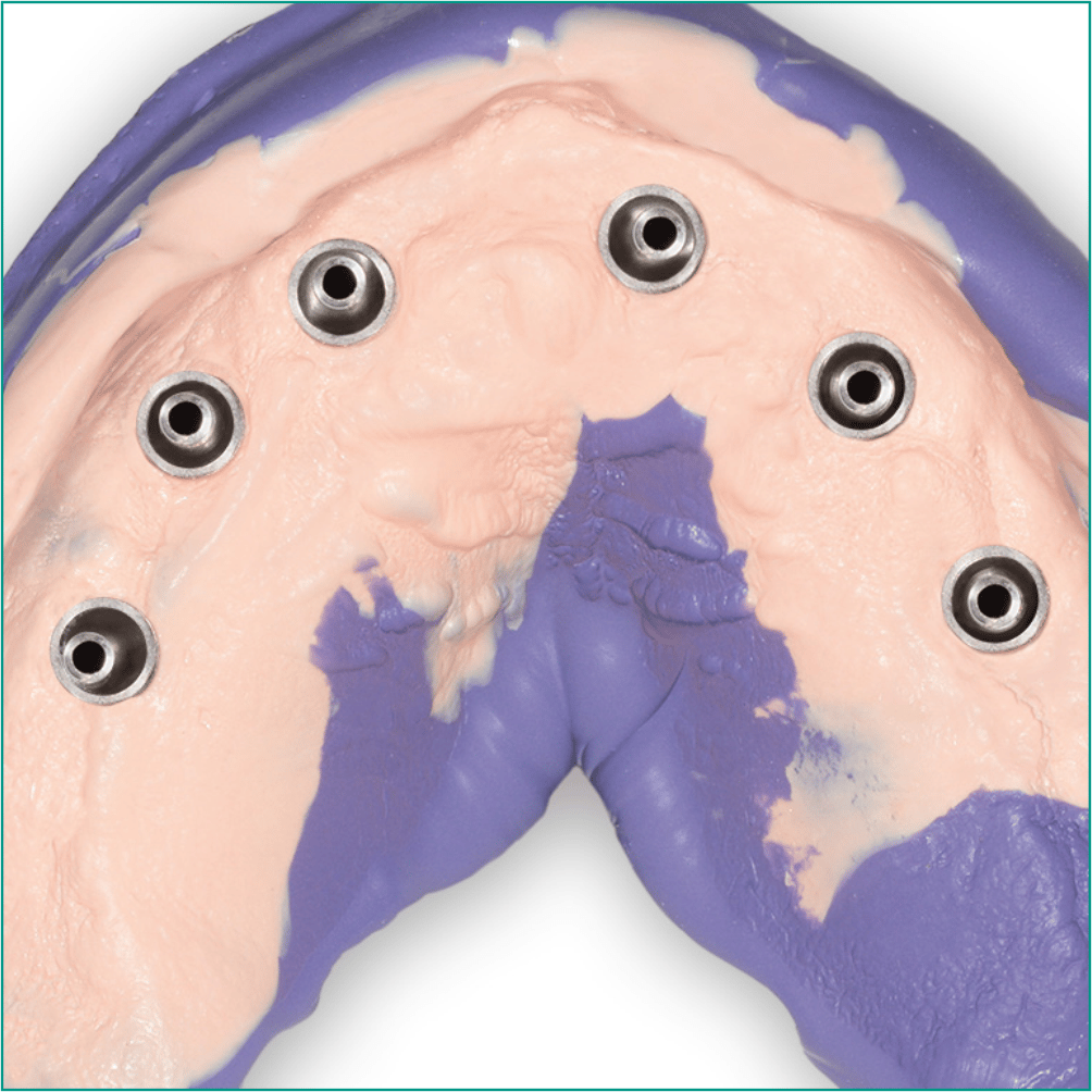 ZHERMACK HYDRORISE IMPLANT LIGHT BODY NORMAL A Silikon