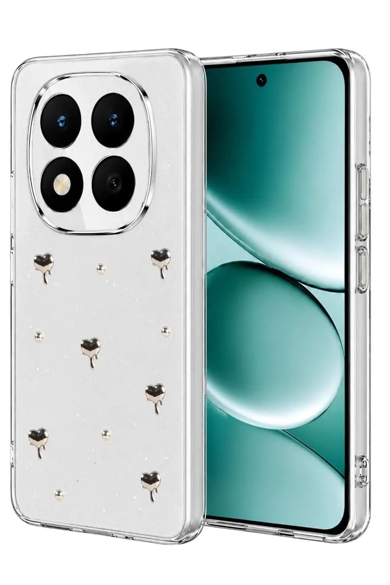 Mey İthalat®   Redmi Note 15 Pro Plus 5G Fiyonk Desenli Kapak - Desen 1