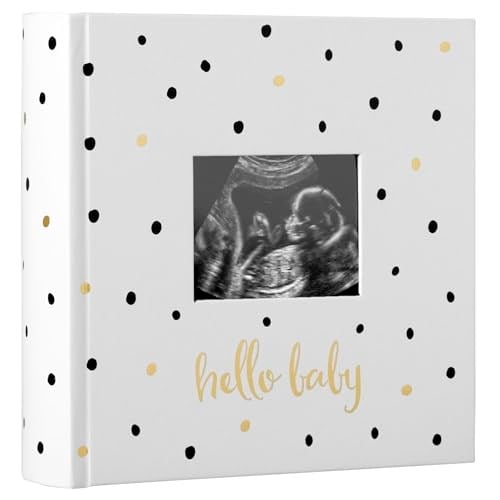 Pearhead Hello Baby Fotoğraf Albümü, Yeni ve Bekleyen Ebeveynler için Bebek Kitabı Hatırası, Cinsiyetsiz Bebek Aksesuarı, 200 Fotoğraf Tutar, Siyah ve Altın Puantiyeli