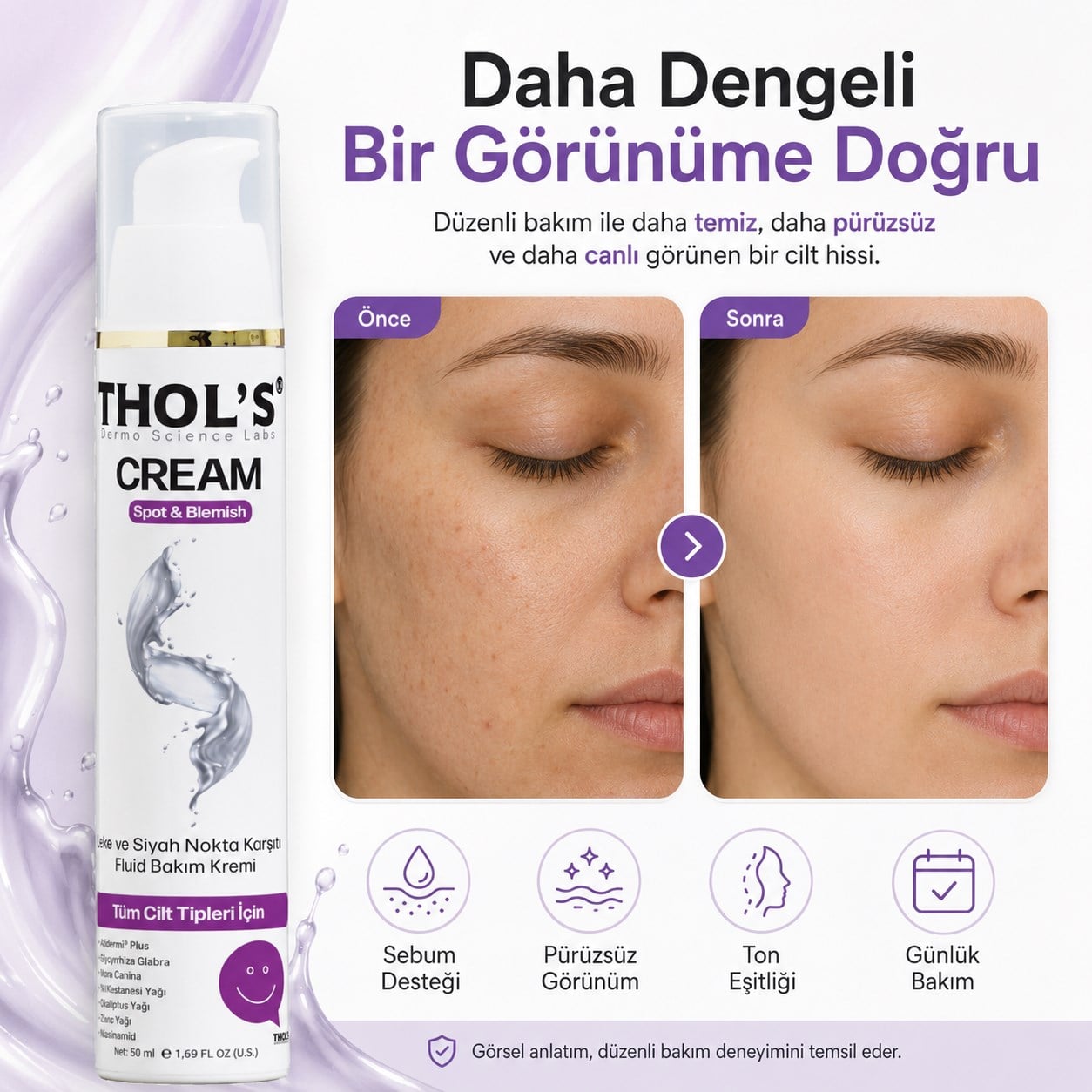 THOL’S Cream Spot & Blemish Leke ve Siyah Nokta Karşıtı Fluid Bakım Kremi 50 ml