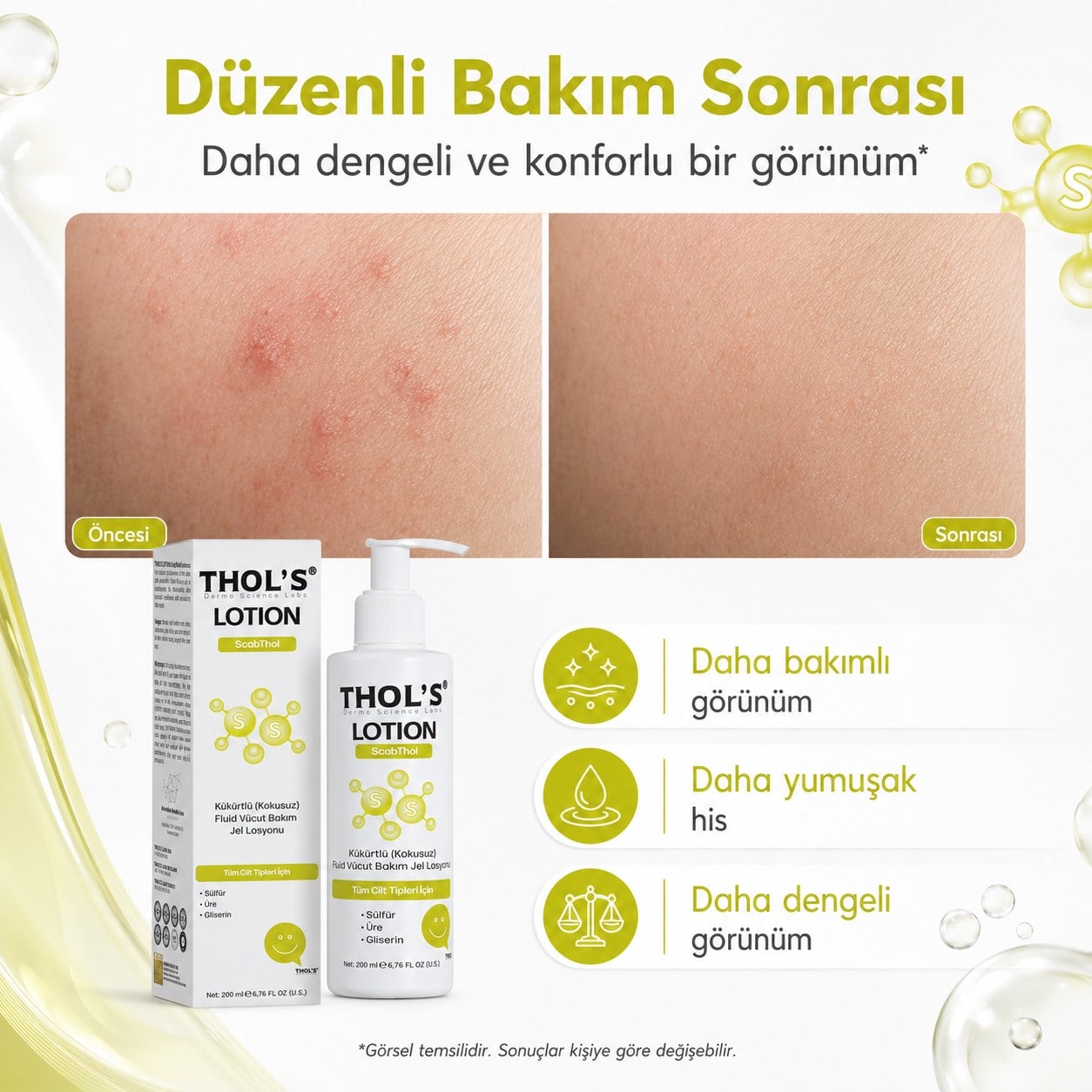 THOL’S LOTION ScabThol Kükürtlü Kokusuz Fluid Vücut Bakım Jel Losyonu - 200 ml