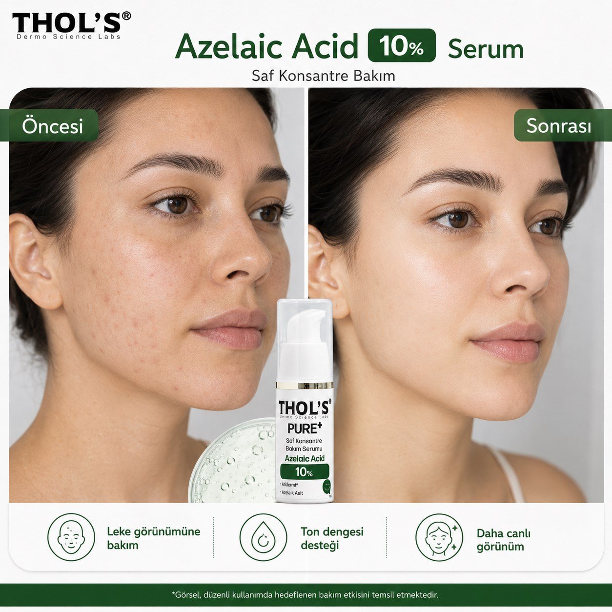 THOL’S PURE+ Azelaic Acid 10% Saf Konsantre Bakım Serumu - 15 ml