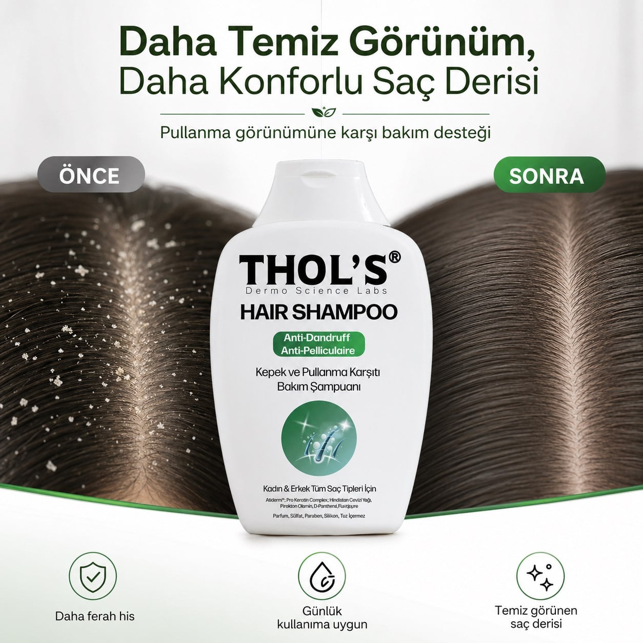 THOLS TB30 Kepek ve Pullanma Karşıtı Bakım Şampuan Tüm Saçlar ve Günlük Kullanım 300 ML