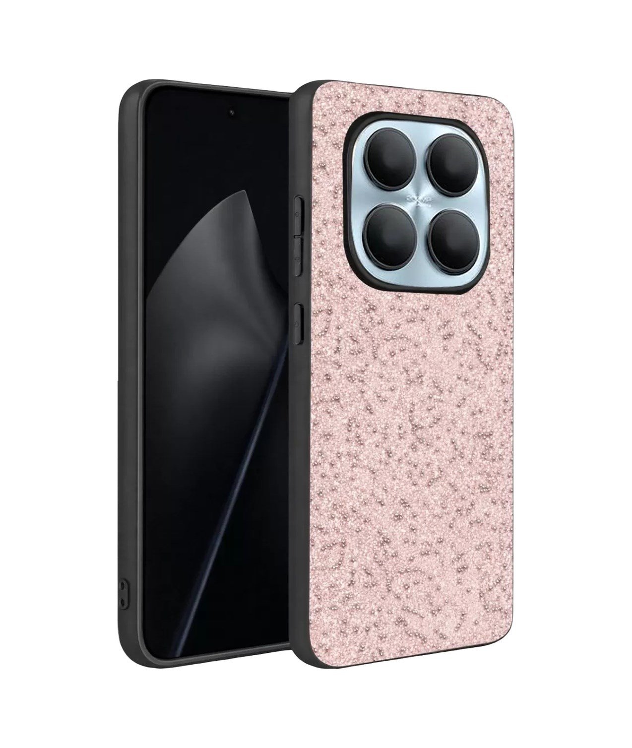 Onegif Xiaomi Redmi Note 15 Pro 5g Uyumlu Bright Simli Kapak - Pembe Belirtilmemiş