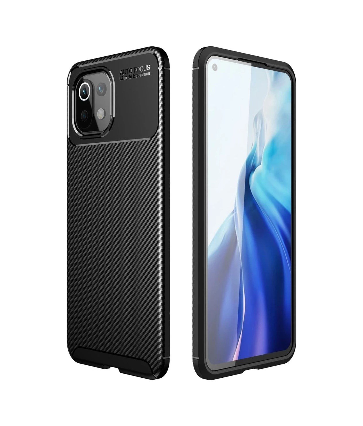 Xiaomi Mi 11 Lite Uyumlu Kılıf Auto Focus Karbon Kapak - Siyah Belirtilmemiş