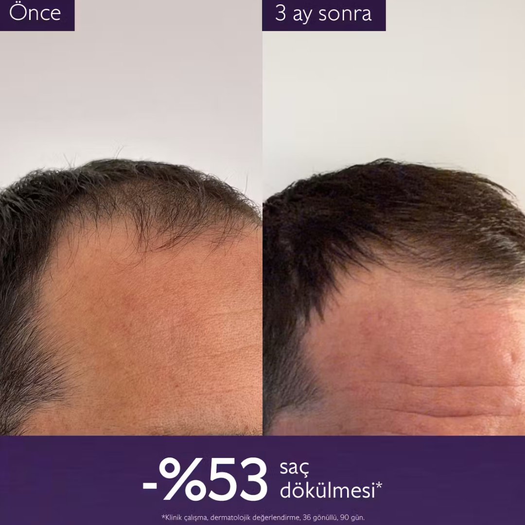 Caudalie Anti-Hair Loss Dökülme Karşıtı Saç Serumu 50 ml - Caudalie 
