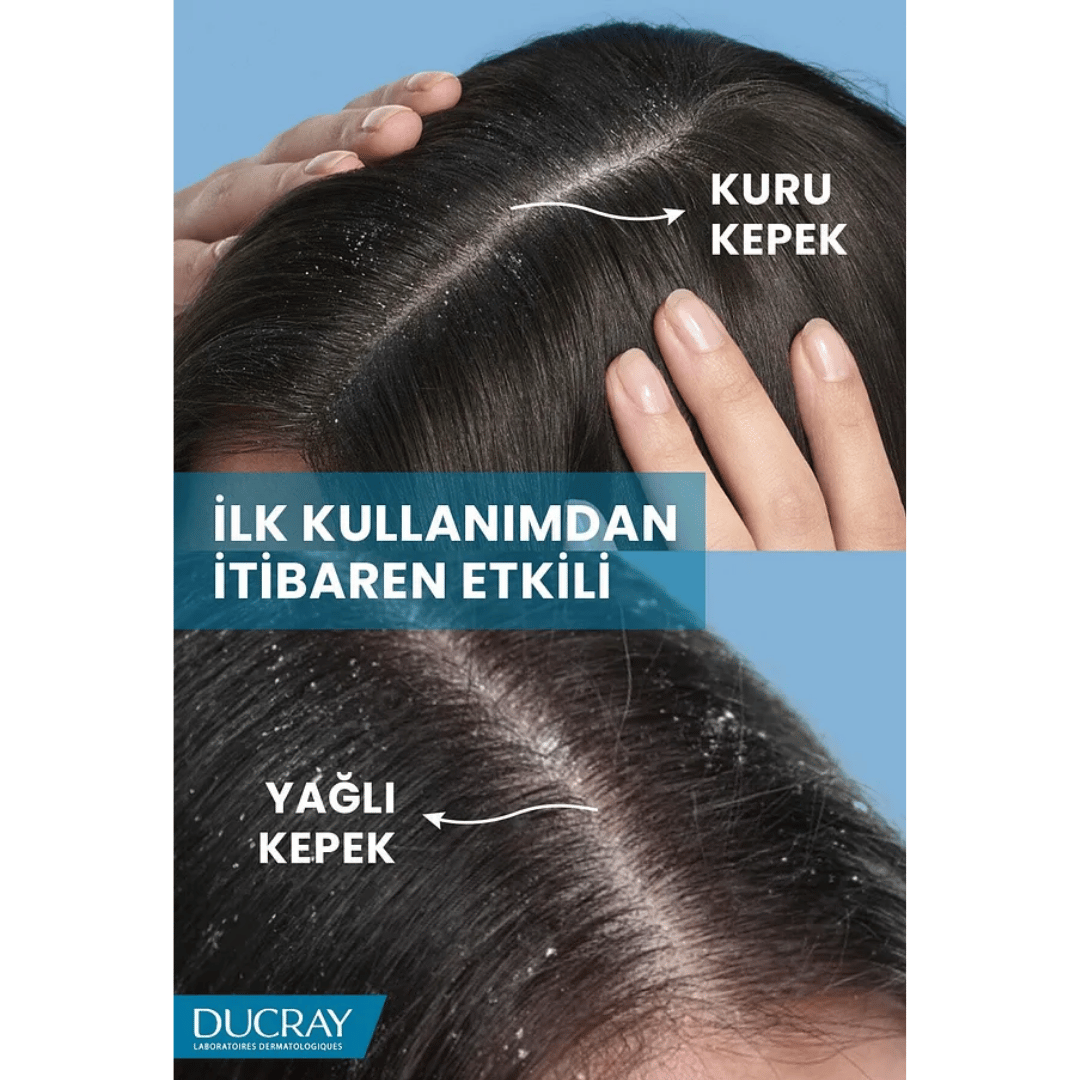 Ducray Kelual Squanorm Kepek Karşıtı Losyon 200 ml - Ducray