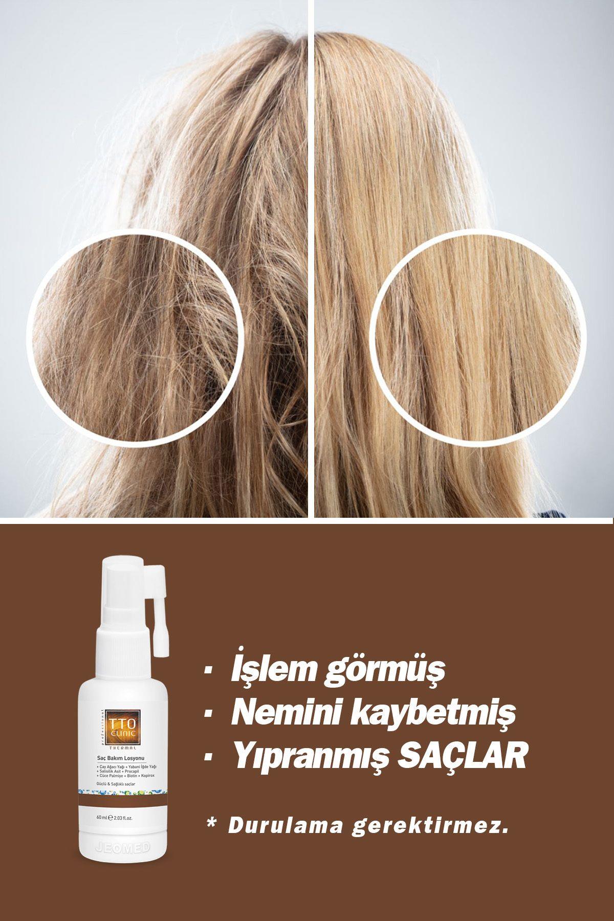TTO Clinic Saç Losyonu 30 ml x 2 Adet - TTO