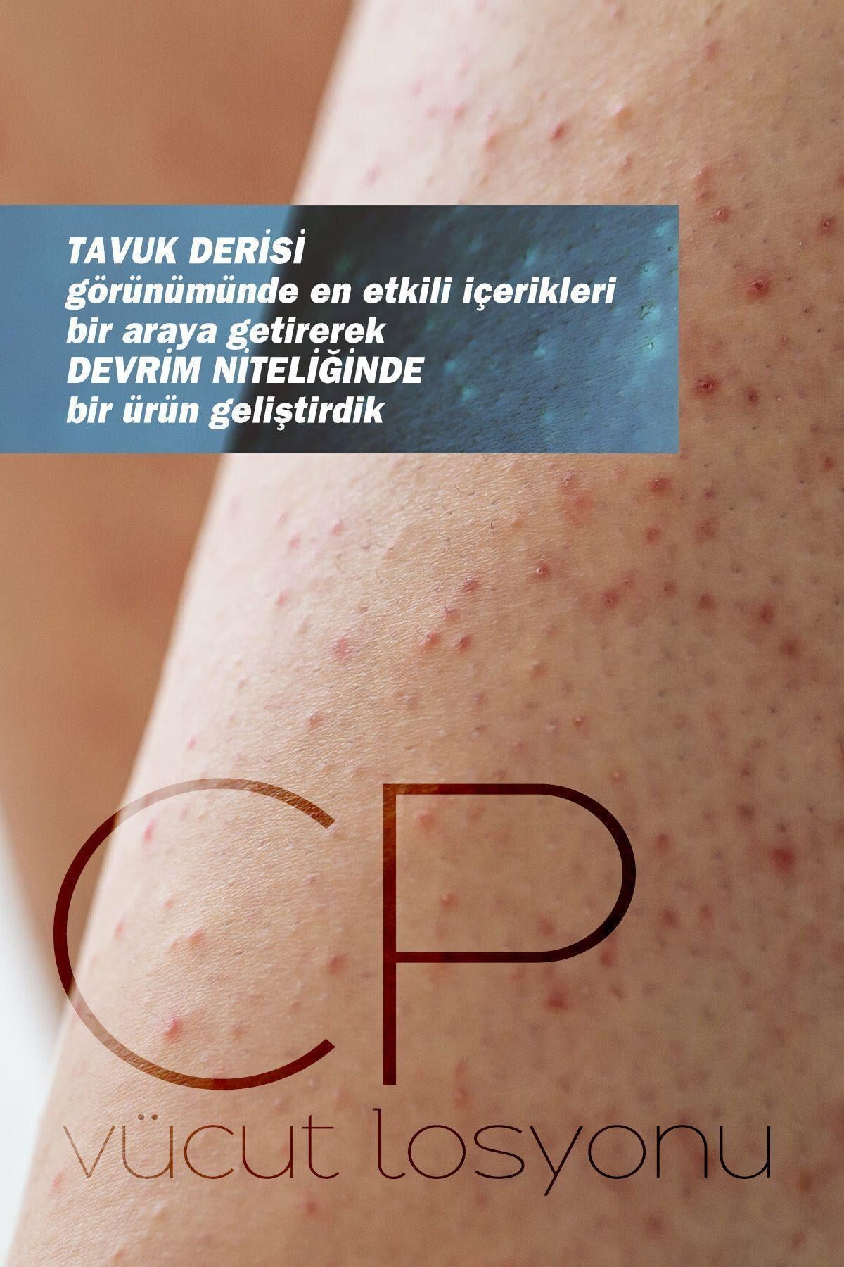 TTO Thermal CP Vücut Losyonu 200 ml - TTO