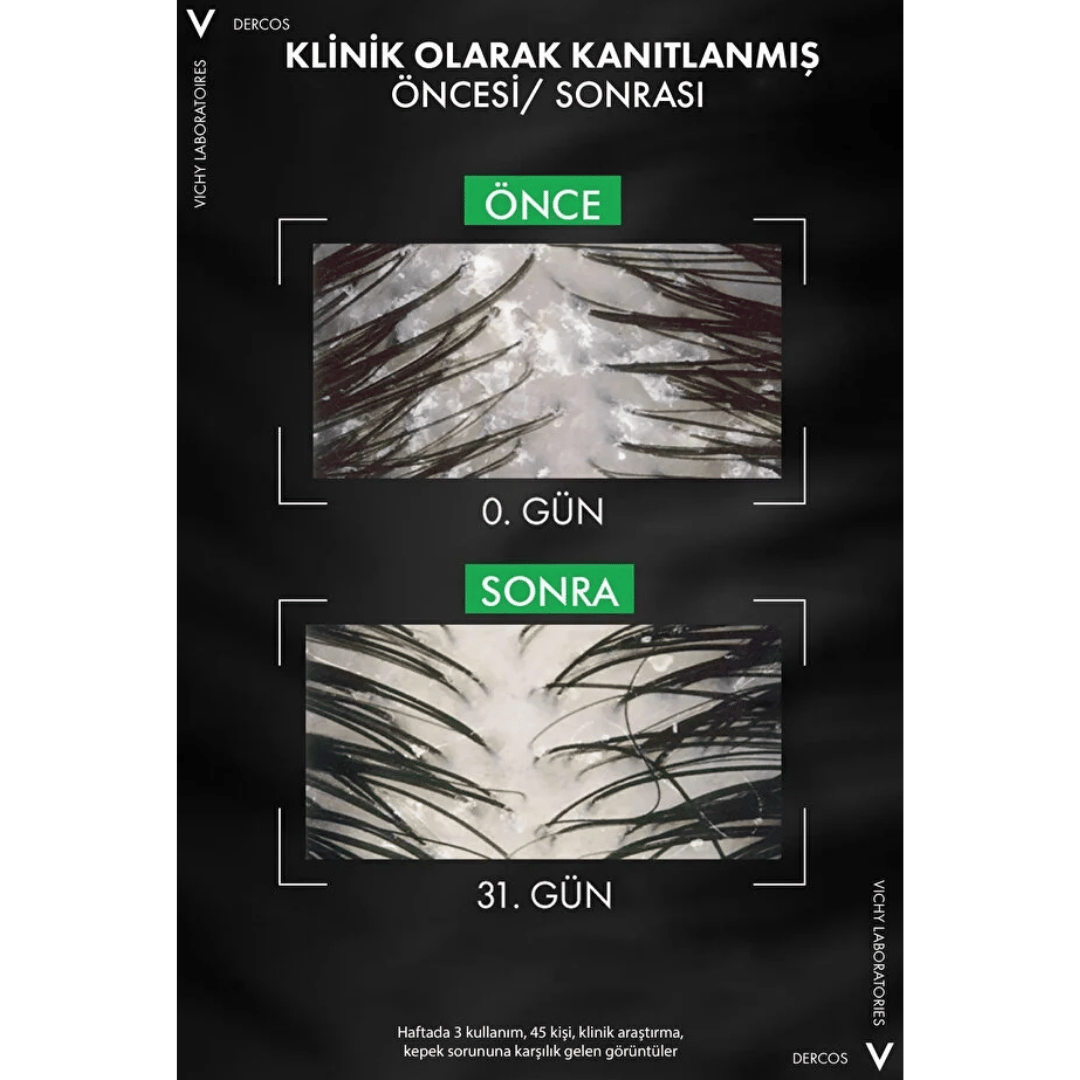 Vichy Dercos 2'si 1 Arada Kepek Karşıtı & Nemlendirici Şampuan 390ml - Vichy