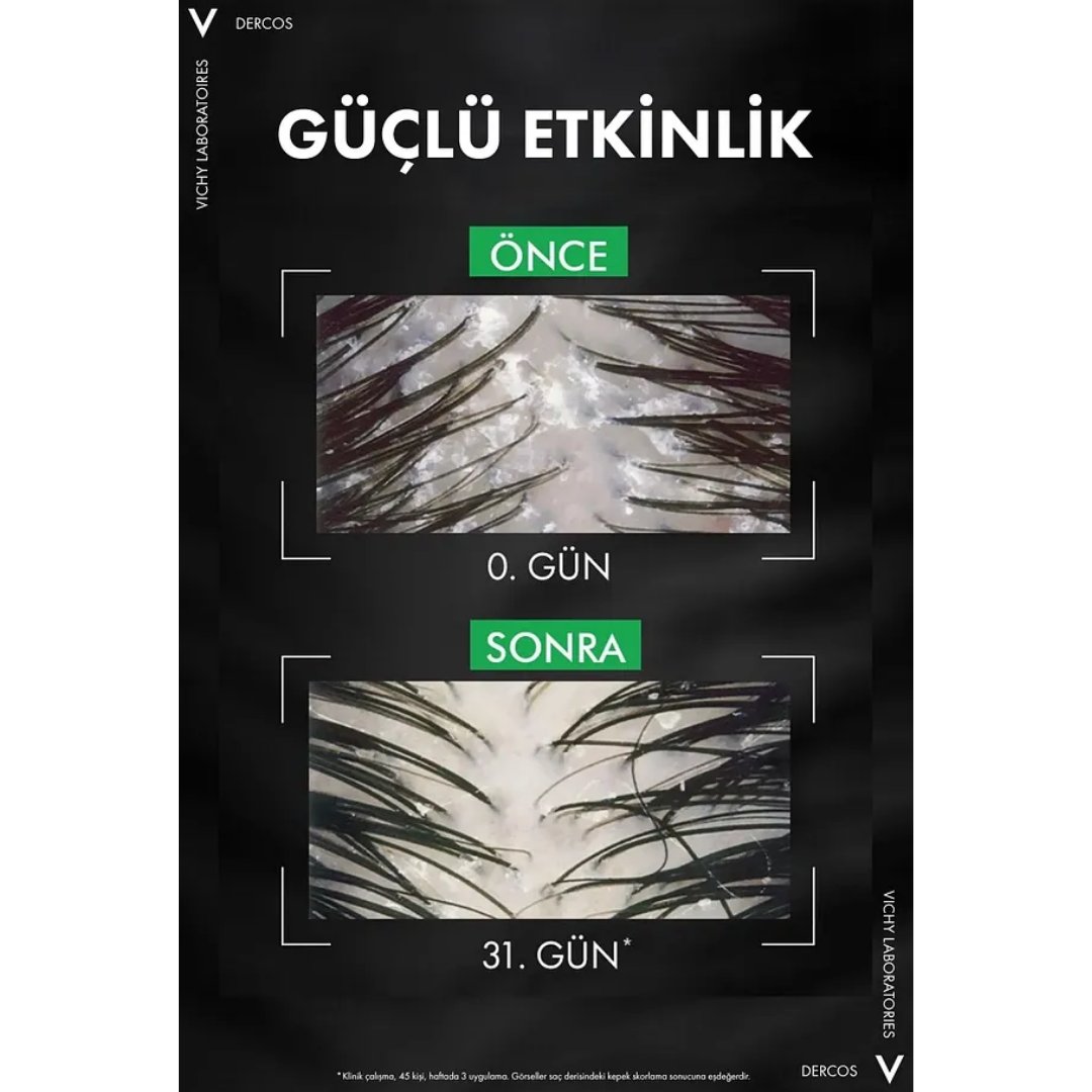 Vichy Dercos Anti Dandruff Kepek Karşıtı Şampuan 390 ml Normal ve Yağlı Saçlar Refill - Vichy