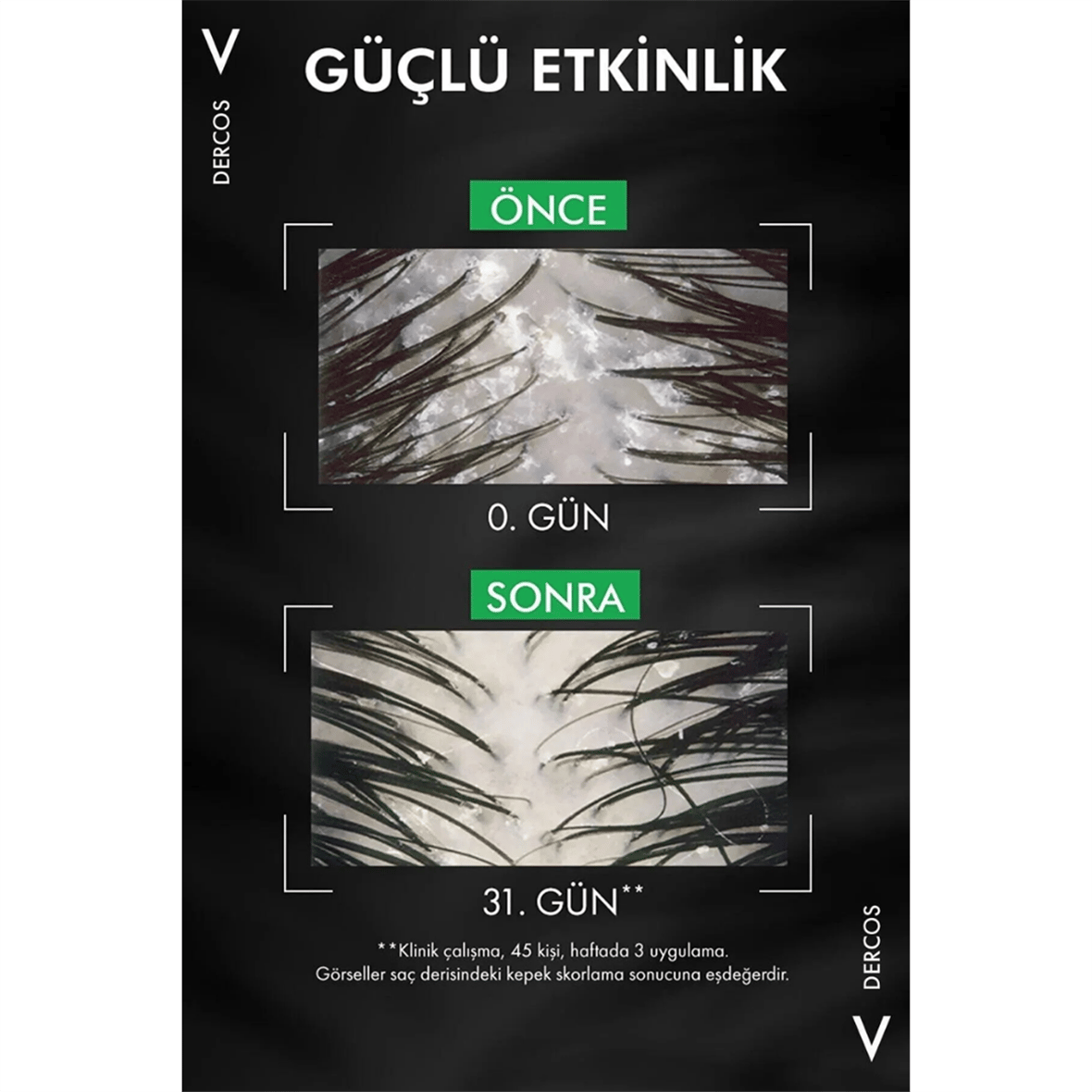 Vichy Dercos Anti-dandruff Kepek Karşıtı Bakım Şampuanı, Kuru Saçlar , Yeniden Dolum Paketi 500 Ml - Vichy