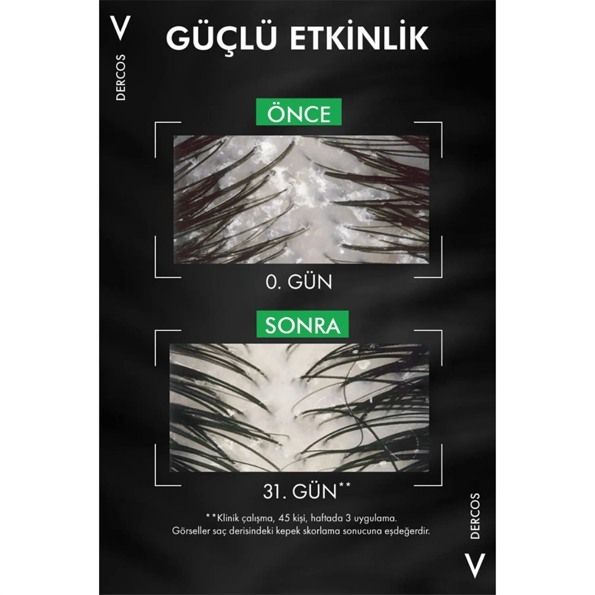 Vichy Dercos Anti-dandruff Kepek Karşıtı Şampuan, Normal & Yağlı Saçlar, Yeniden Dolum Paketi 500 Ml - Vichy