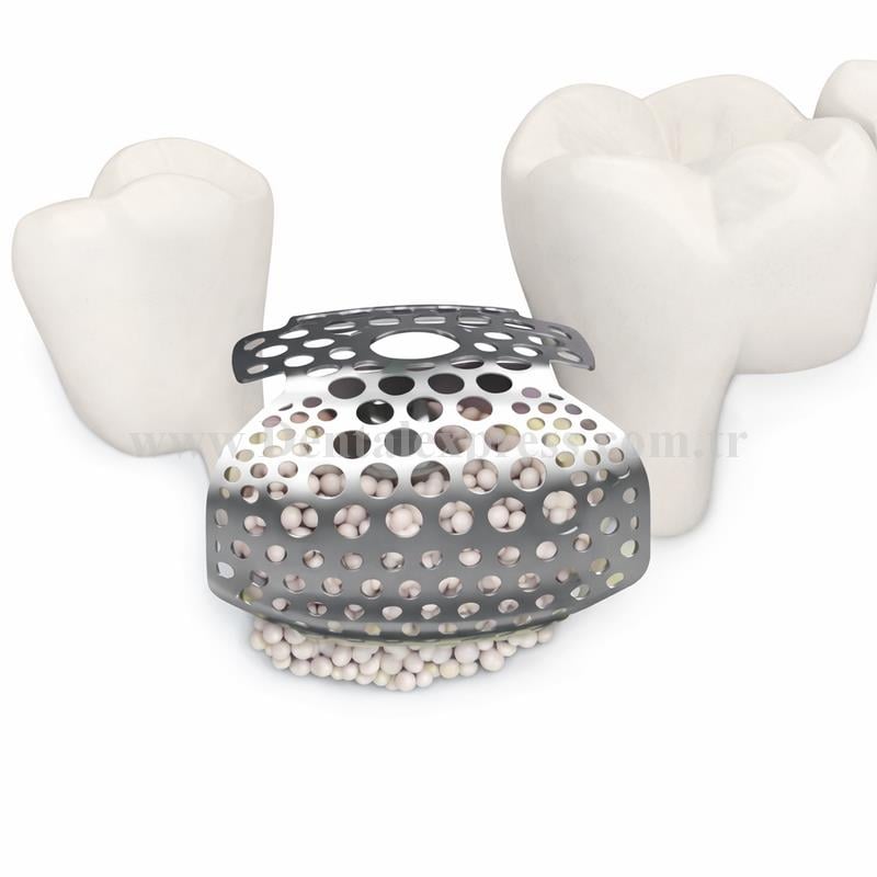 Titanyum Mesh