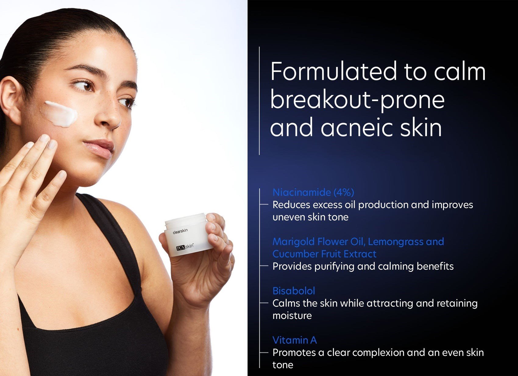 AknelerClearskin