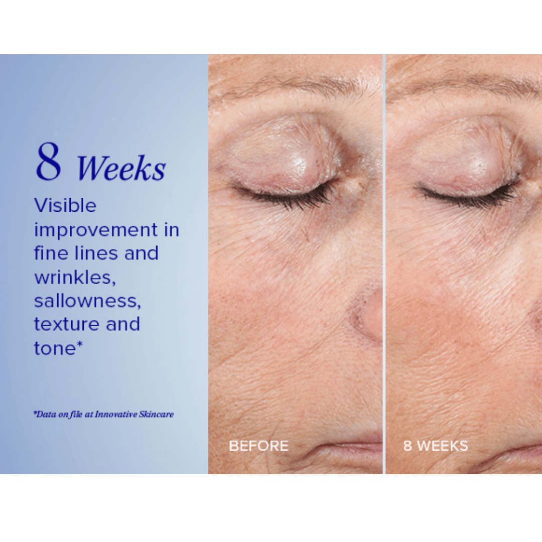 PeelingiS Clinical Active Peel System