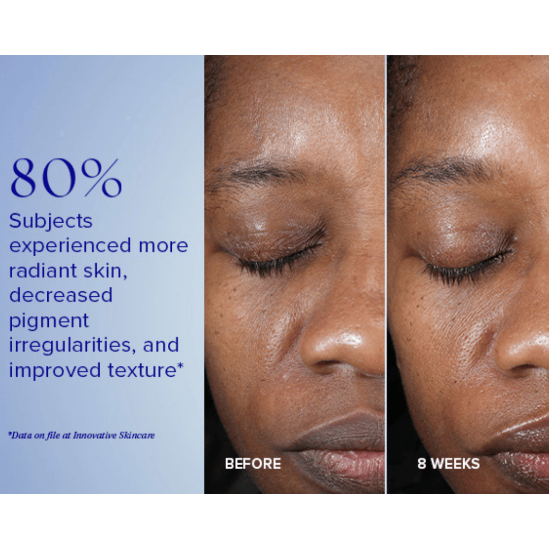 PeelingiS Clinical Active Peel System