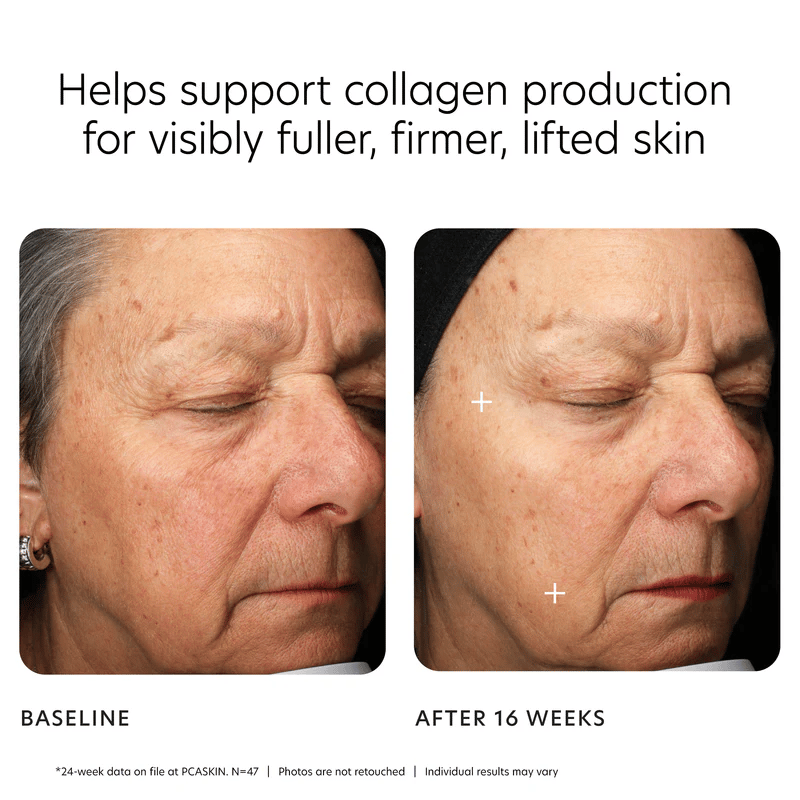 SerumlarMGF Age Renewal Cream