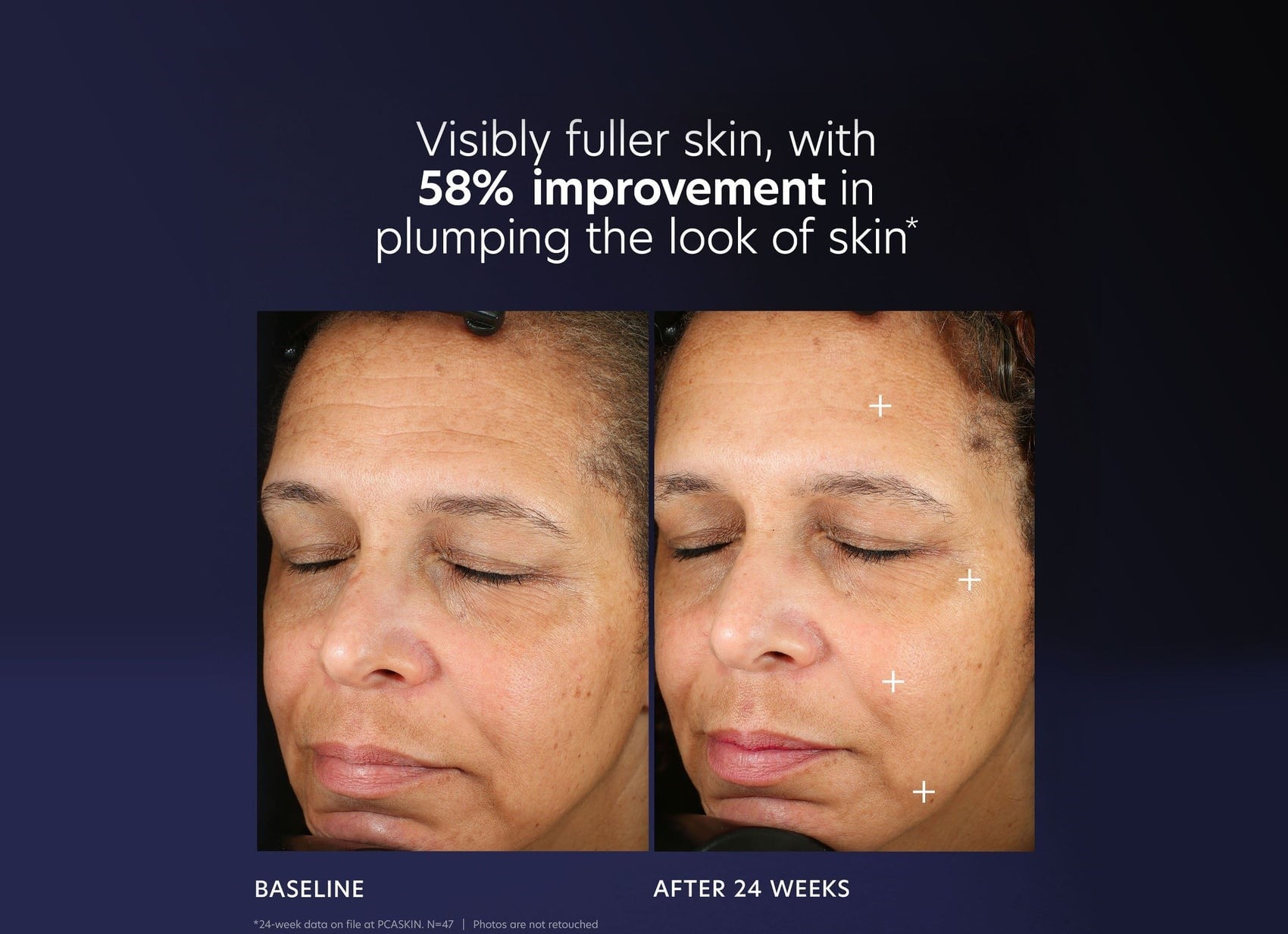 SerumlarPro-Max Age Renewal