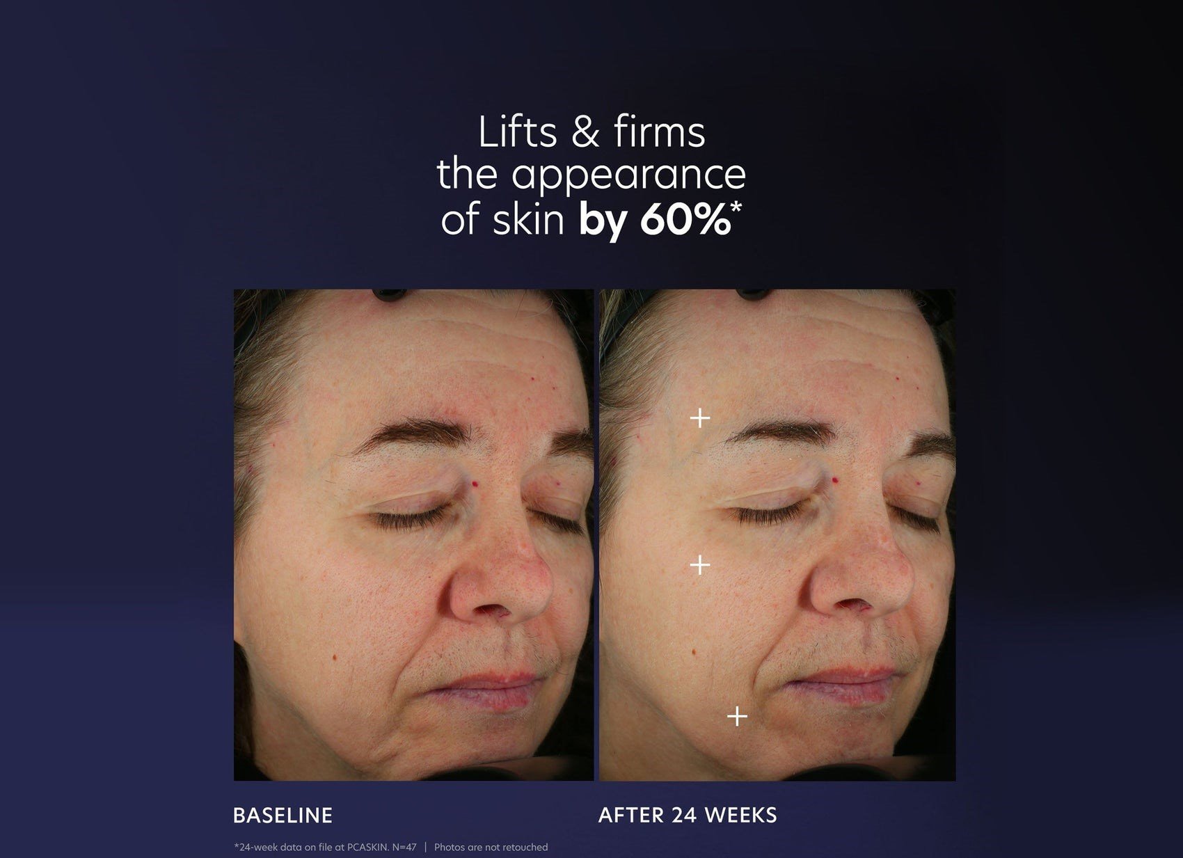 SerumlarPro-Max Age Renewal