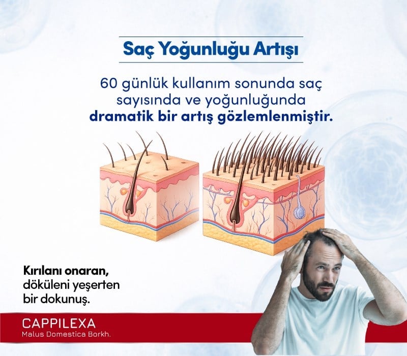 Cappilexa Malus Domestica Borkh.