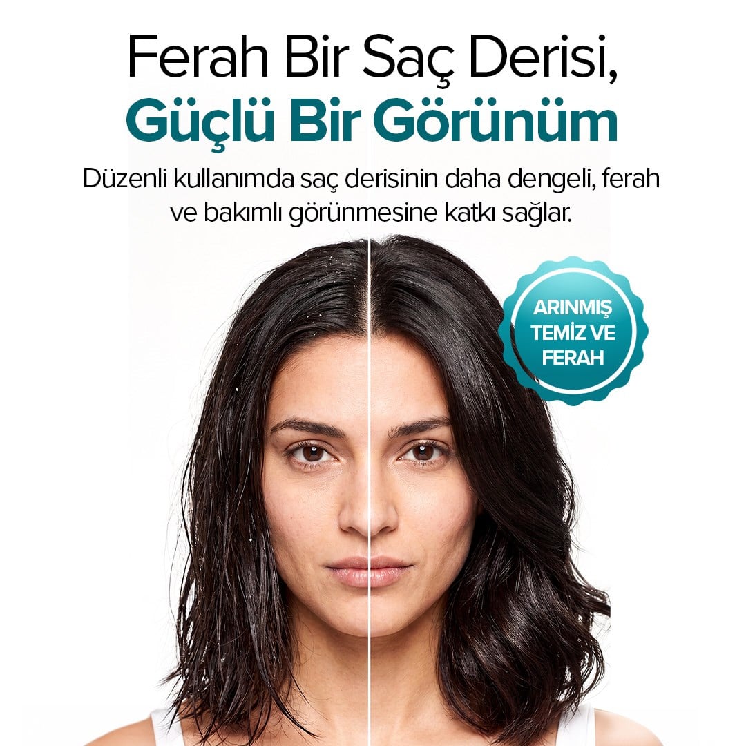 Scalpcare Tonic – Profesyonel Saç Derisi Bakım Toniği