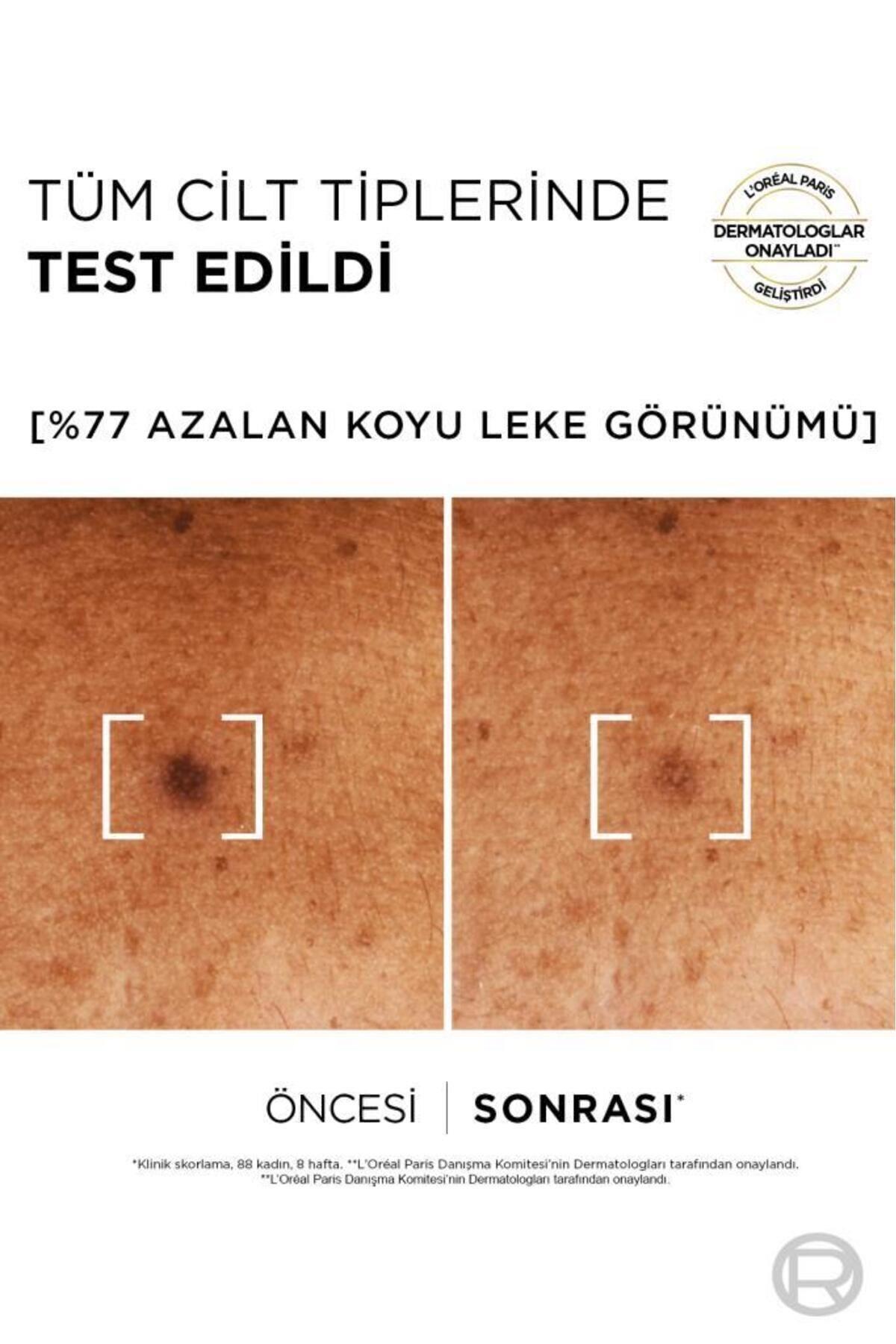 L'Oreal Paris Bright Reveal Sivilce,Güneş,Yaşlanma Lekelerinde Etkili Koyu Leke Karşıtı Cilt Serumu 7,5%Niasinamid