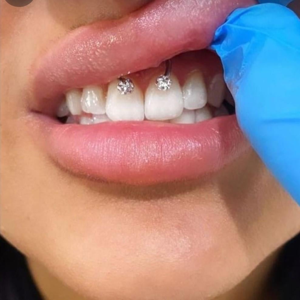 8 mm Gümüş Renk İki Ucu Taşlı Cerrahi Çelik Tragus Helix Piercing Kıkırdak Septum
