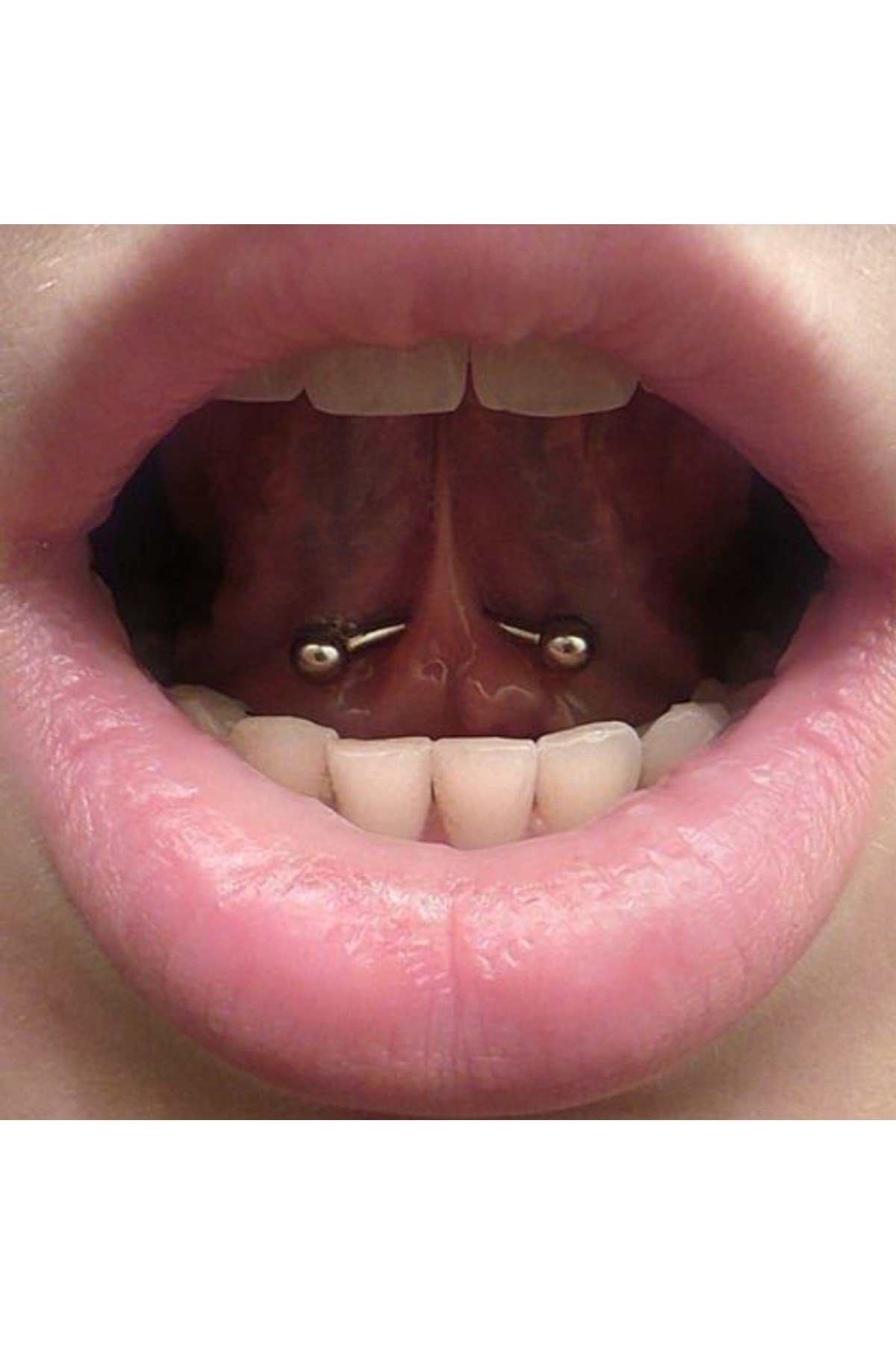 Cerrahi Çelik İki Ucu Toplu Dil Dudak Piercingi 8 mm Gümüş Renk