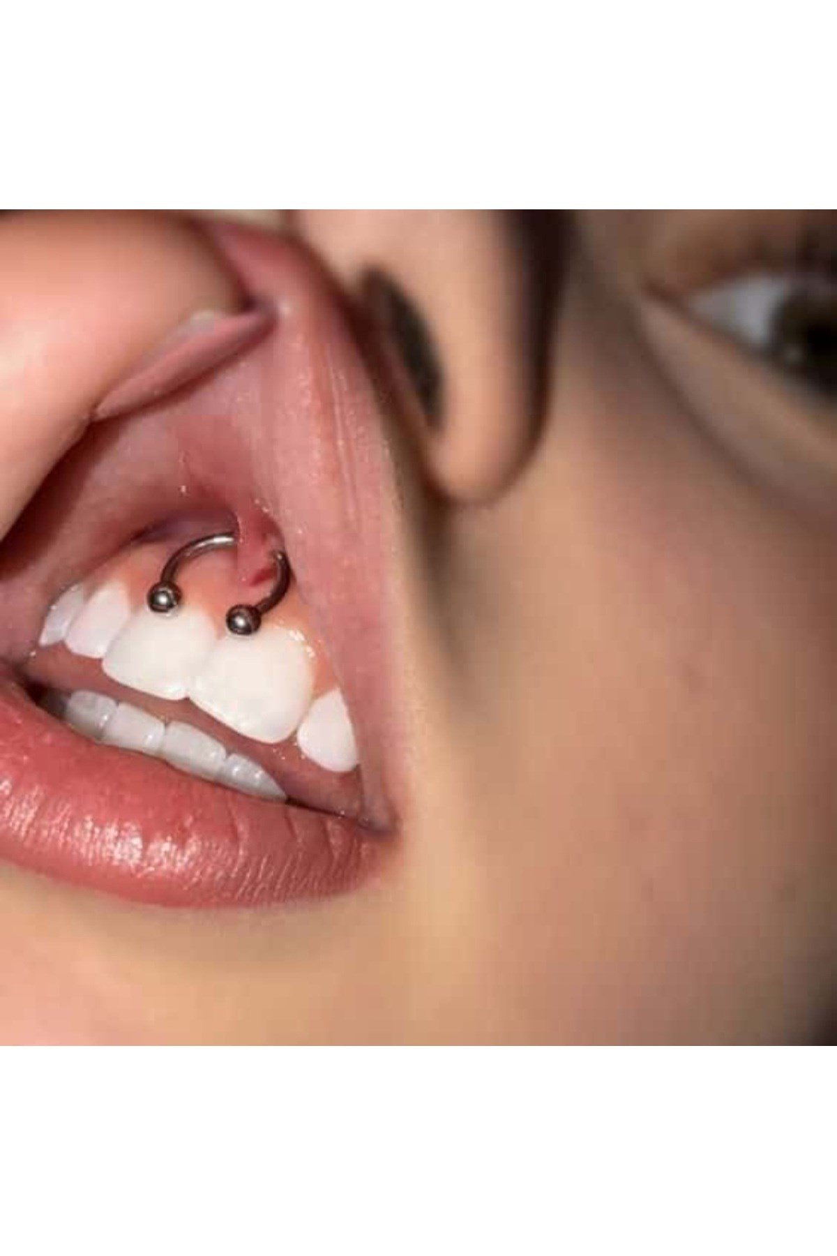 Cerrahi Çelik Ucu Toplu Dudak Piercingi 8 mm Gümüş Renk Smile Piercing