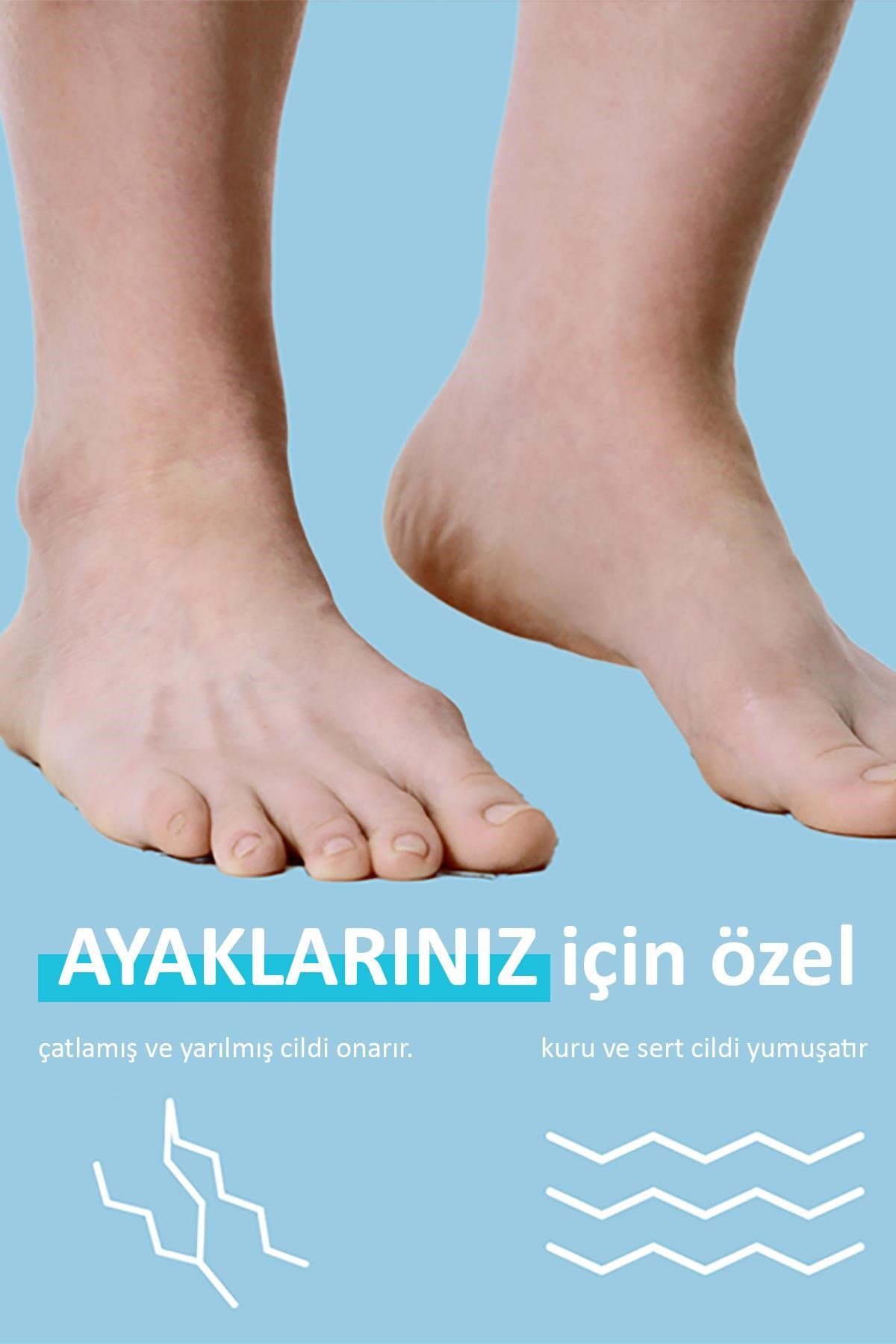 AmLactin 15% Lactic Acid Topuk ve Ayak Bakım Kremi 85GR