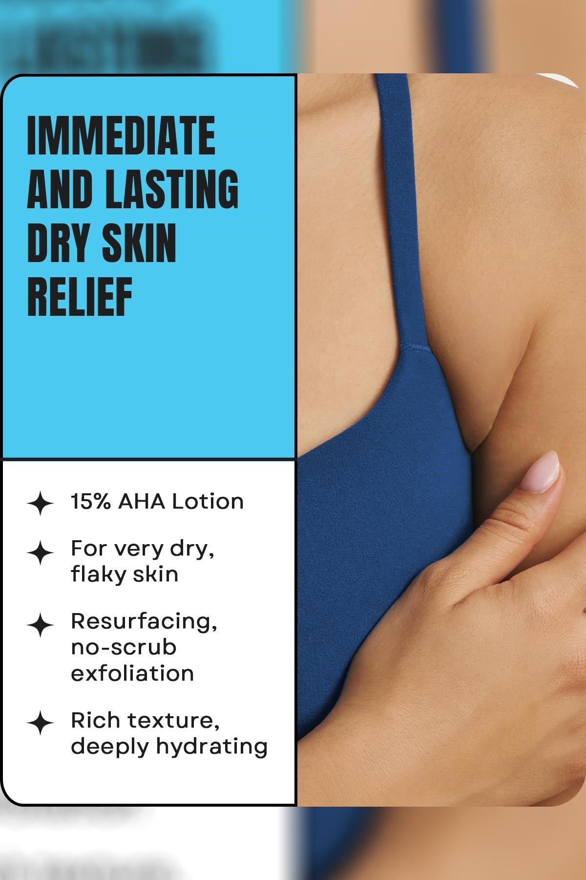 AmLactin 15% Lactic Acid Yoğun Onarıcı Bakım Kremi 340GR