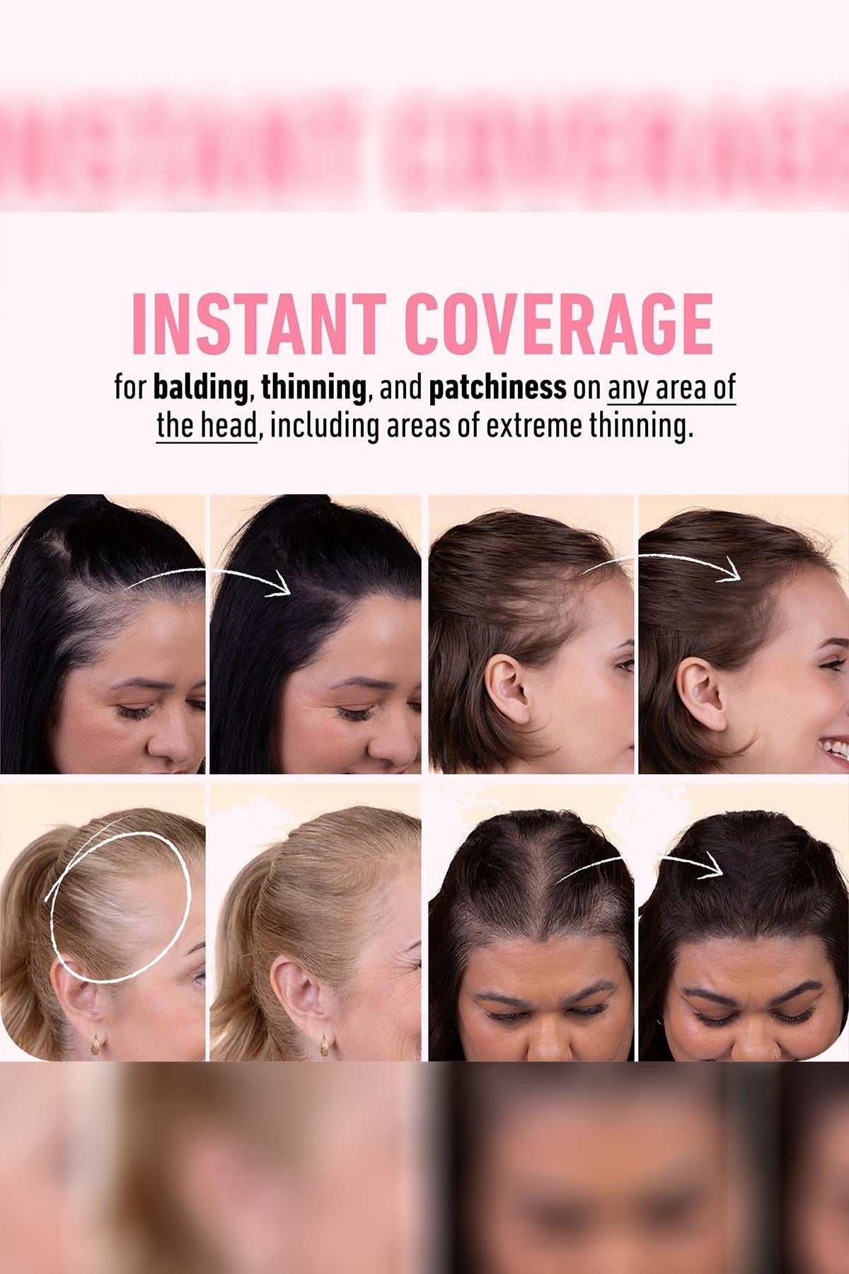 Boldify Hairline Powder Dip Kapatıcı Saç Pudrası Siyah 4GR