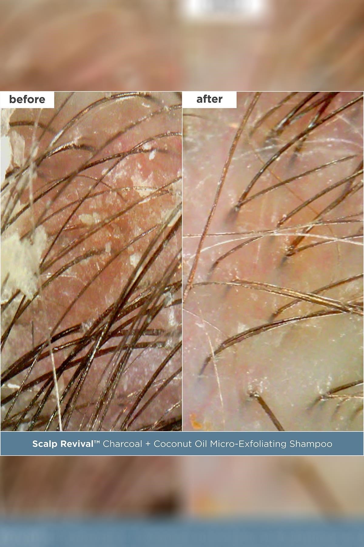 Briogeo Scalp Revival Saç Derisi Bakım Seti Seyahat Boyu