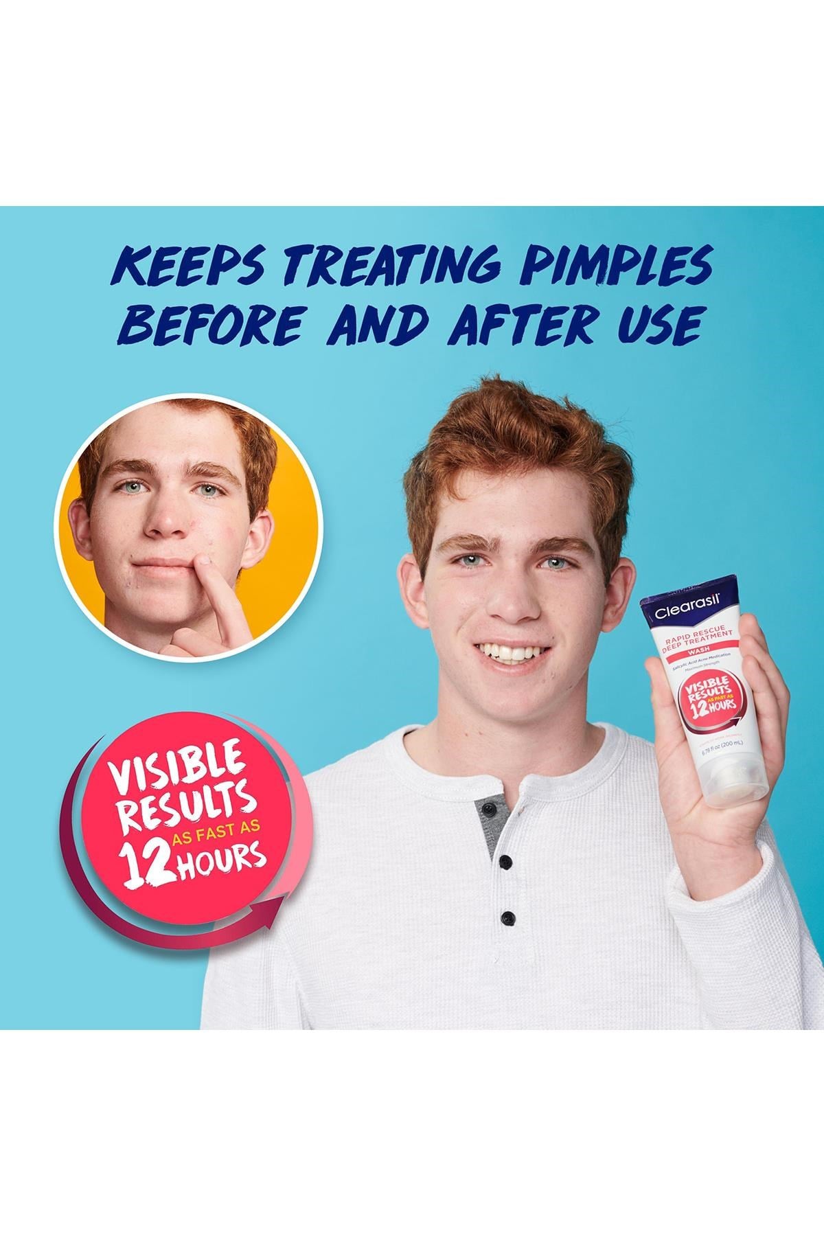 Clearasil Rapid Rescue Akne Karşıtı Yüz Temizleme Jeli 200ML