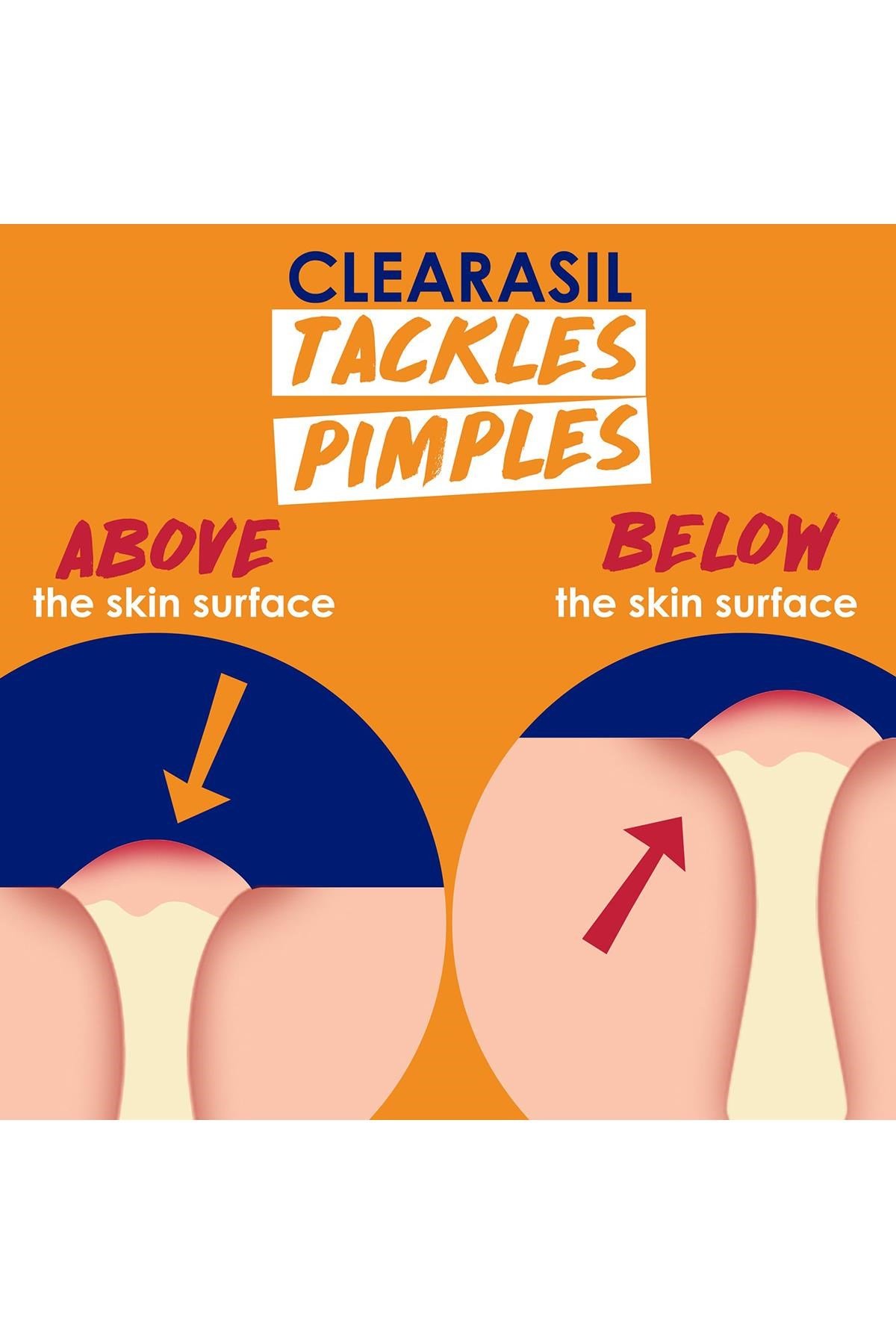 Clearasil Stubborn Akne Karşıtı 5’i 1 Arada Peeling Etkili Yüz Temizleme Jeli 200ML