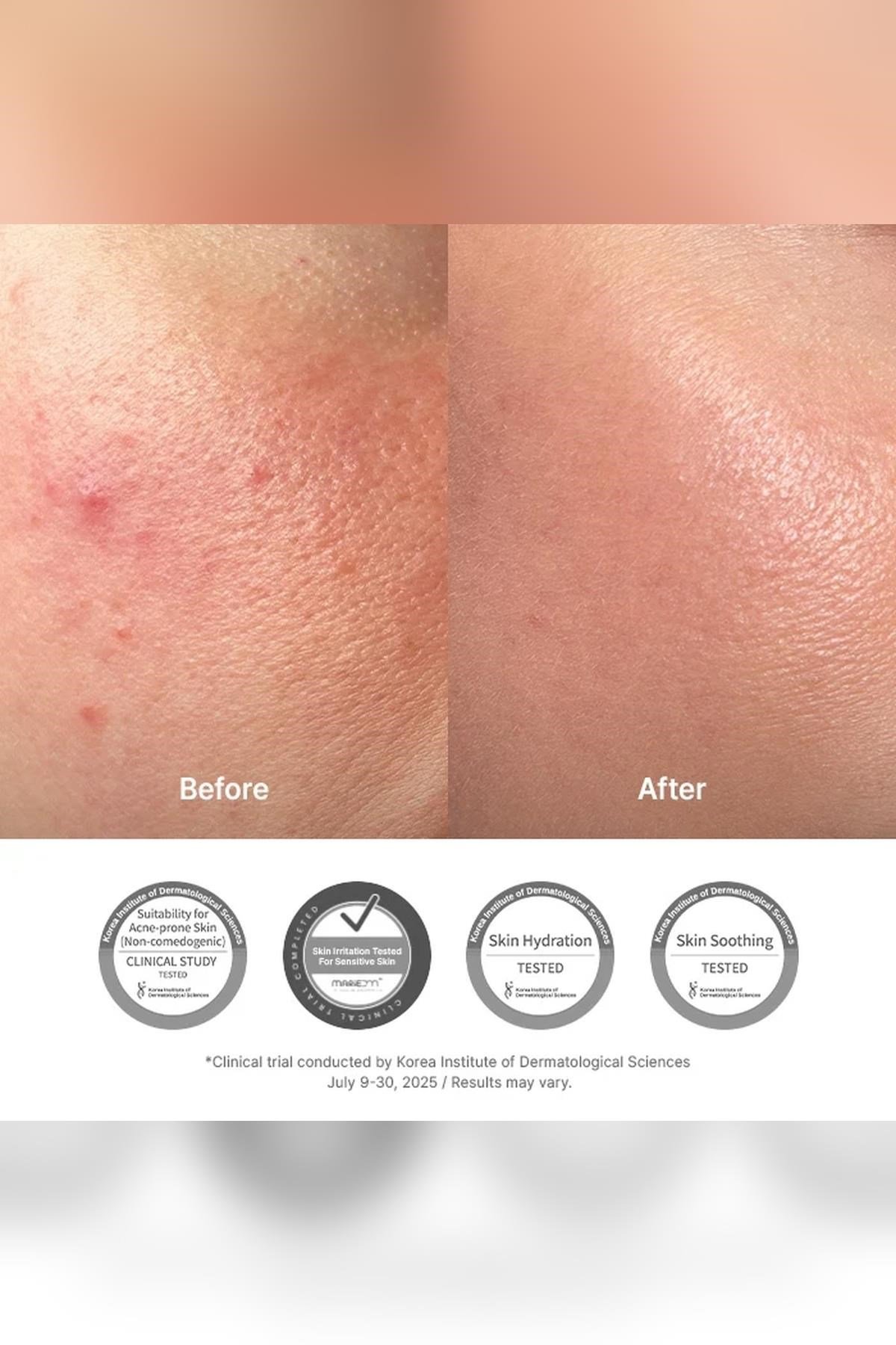 Dr. Althea 345 Relief Cream Akne Karşıtı Yatıştırıcı Yüz Kremi 50ML