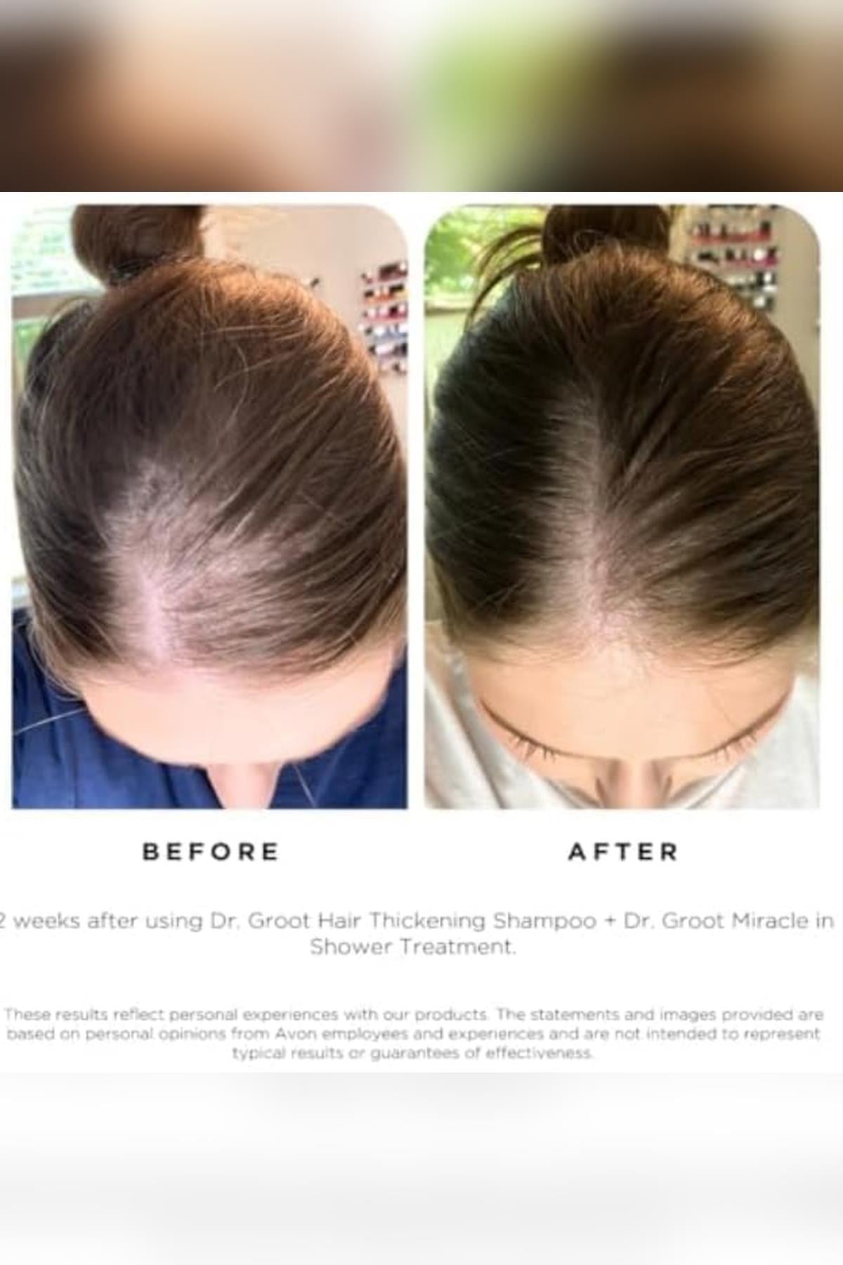 Dr. Groot Scalp Revitalizing Solution Dolgunlaştırıcı Şampuan 700ML