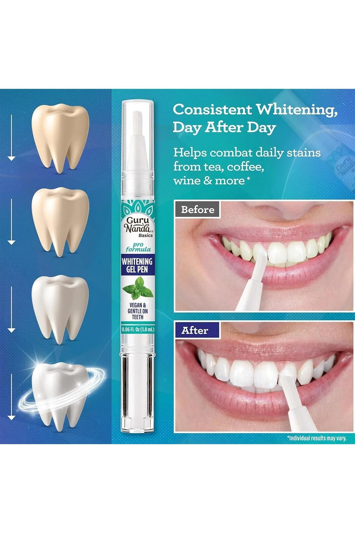 GuruNanda Whitening Gel Pen Diş Beyazlatma Kalemi Jel 1.8ML
